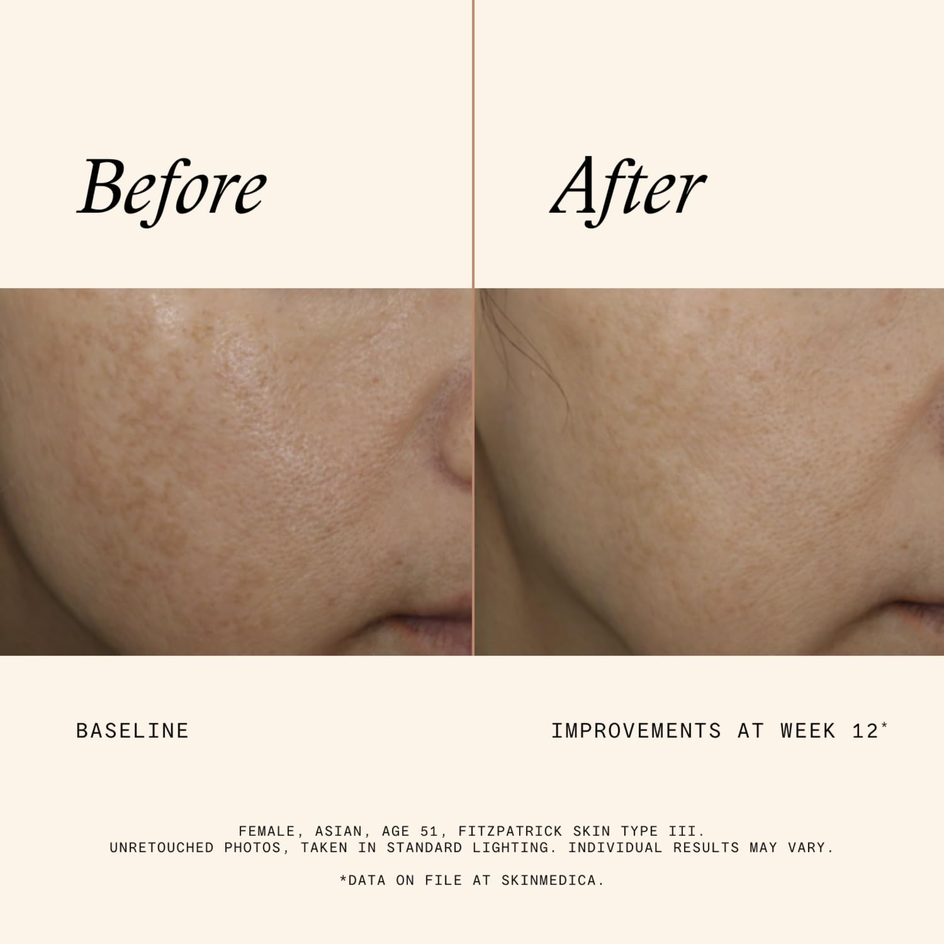 SkinMedica® - Even & Correct Advanced Brightening Treatment - MariposaSkincare.com