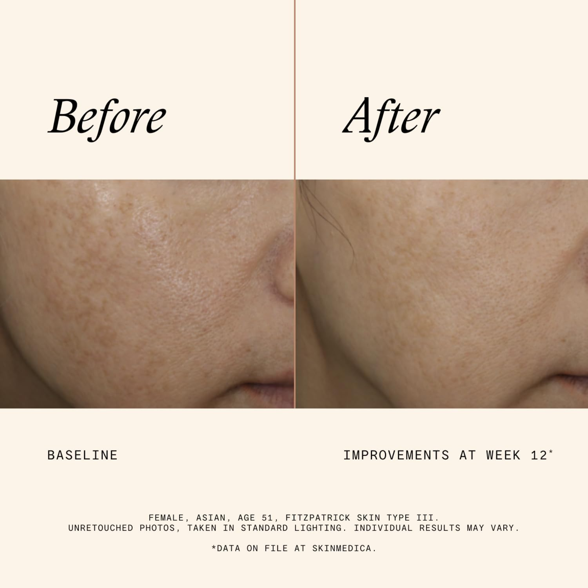 SkinMedica® - Even & Correct Advanced Brightening Treatment - MariposaSkincare.com
