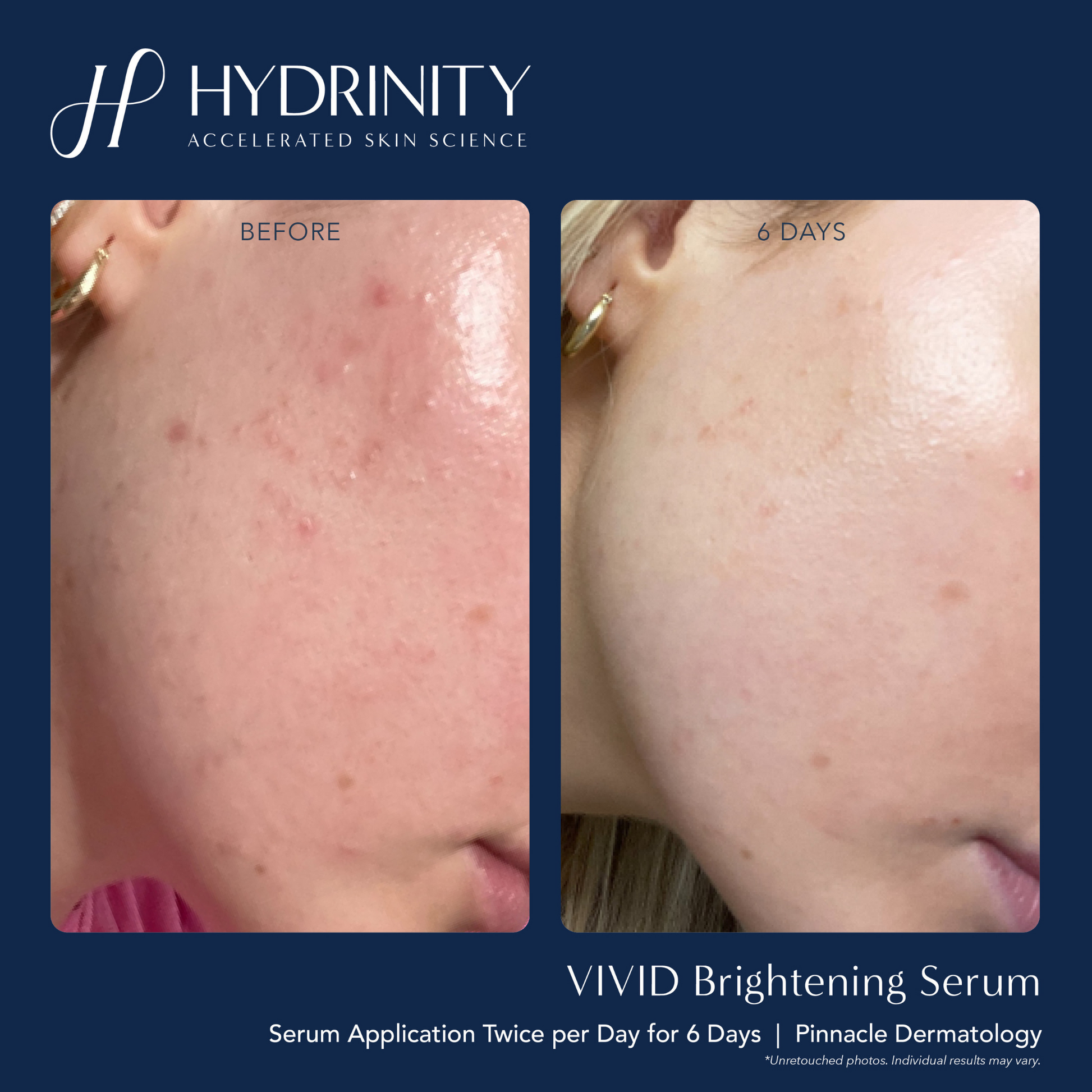 VIVID Brightening Serum - MariposaSkincare.com