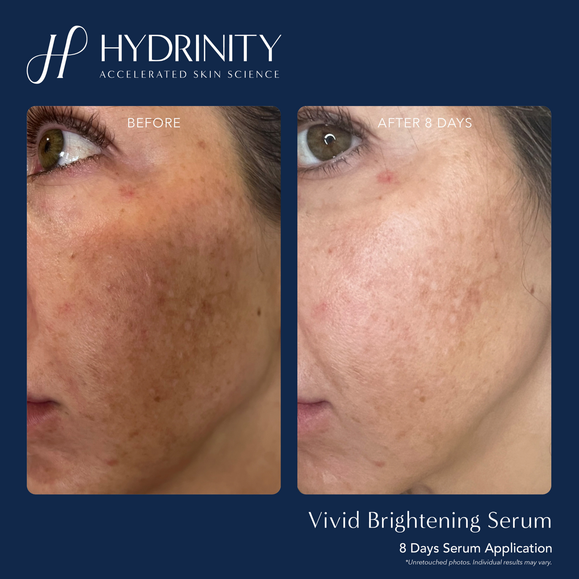 VIVID Brightening Serum - MariposaSkincare.com