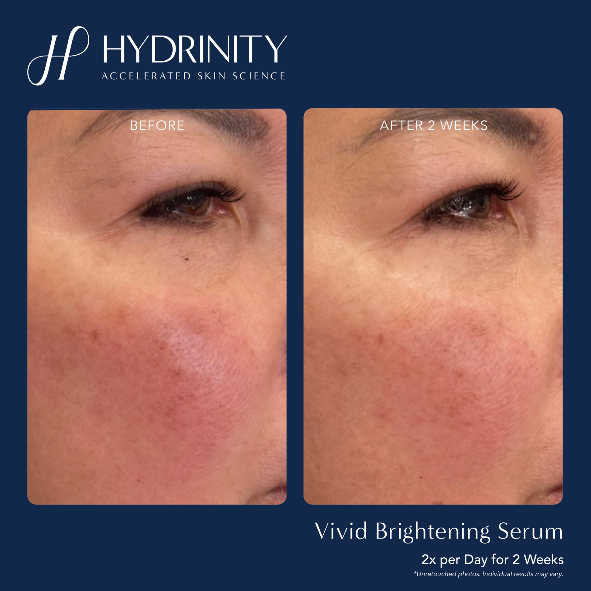 VIVID Brightening Serum - MariposaSkincare.com