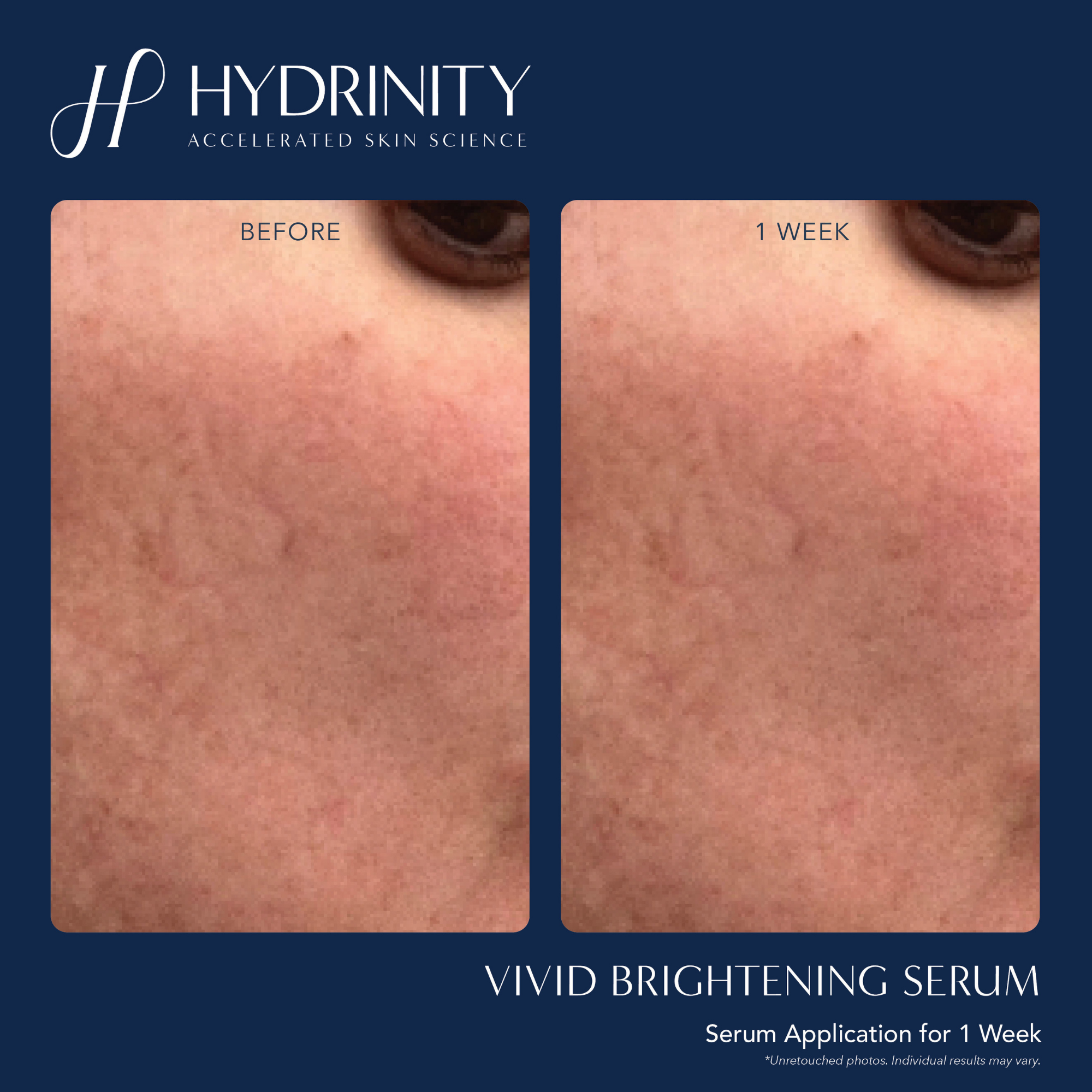VIVID Brightening Serum - MariposaSkincare.com