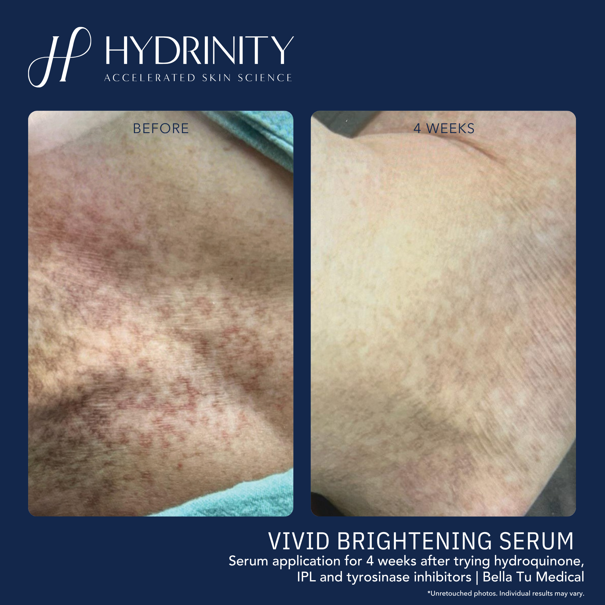 VIVID Brightening Serum - MariposaSkincare.com