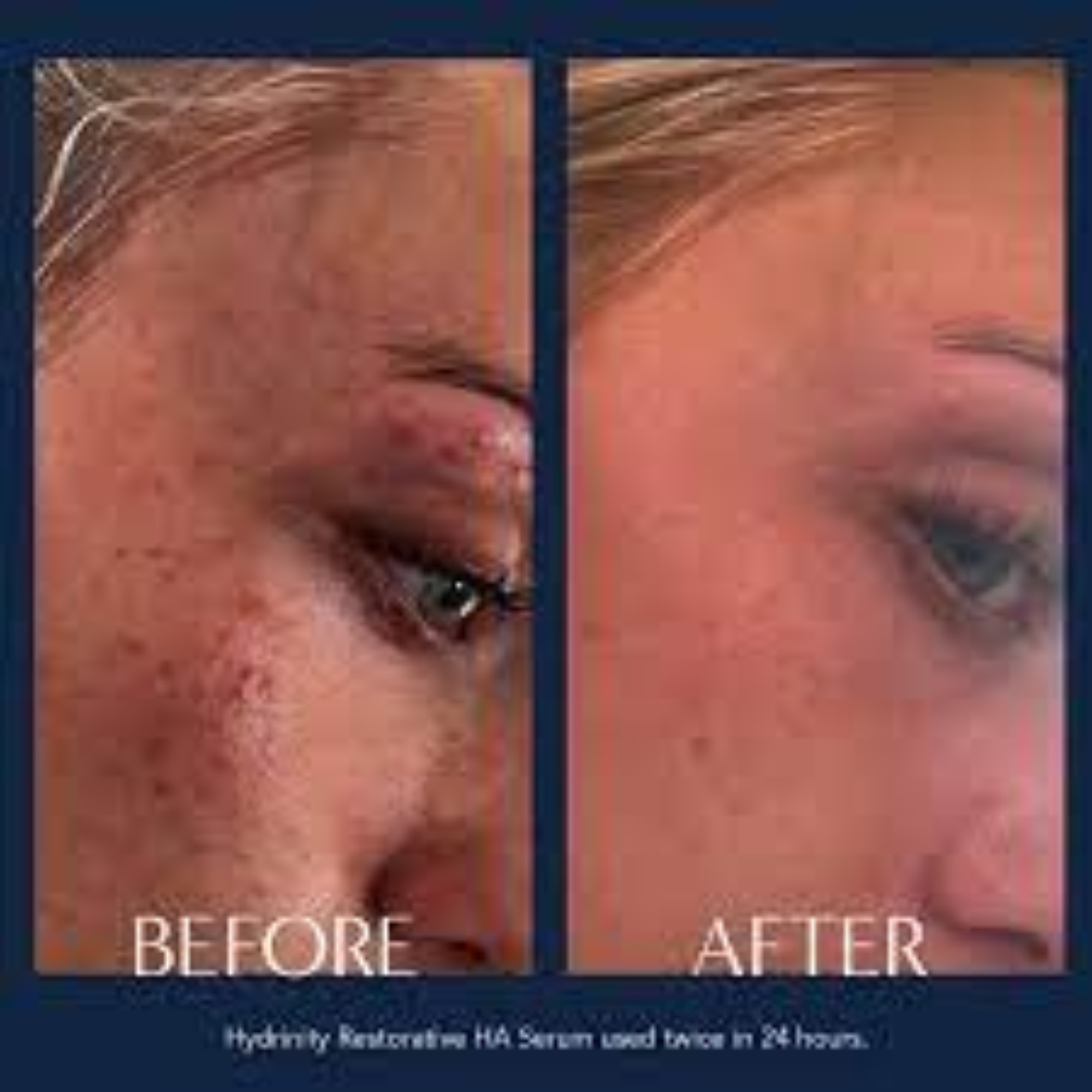 Restorative HA Serum - MariposaSkincare.com