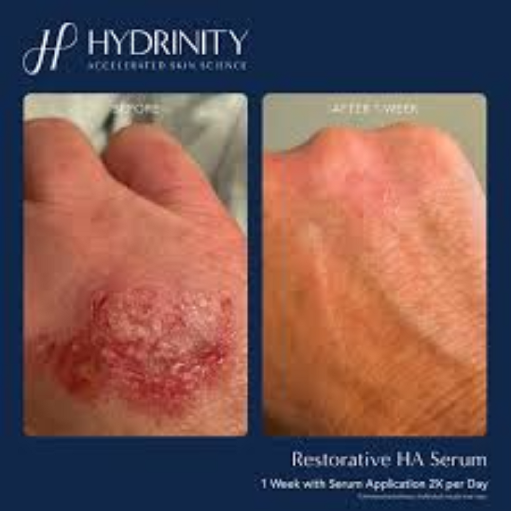 Restorative HA Serum - MariposaSkincare.com