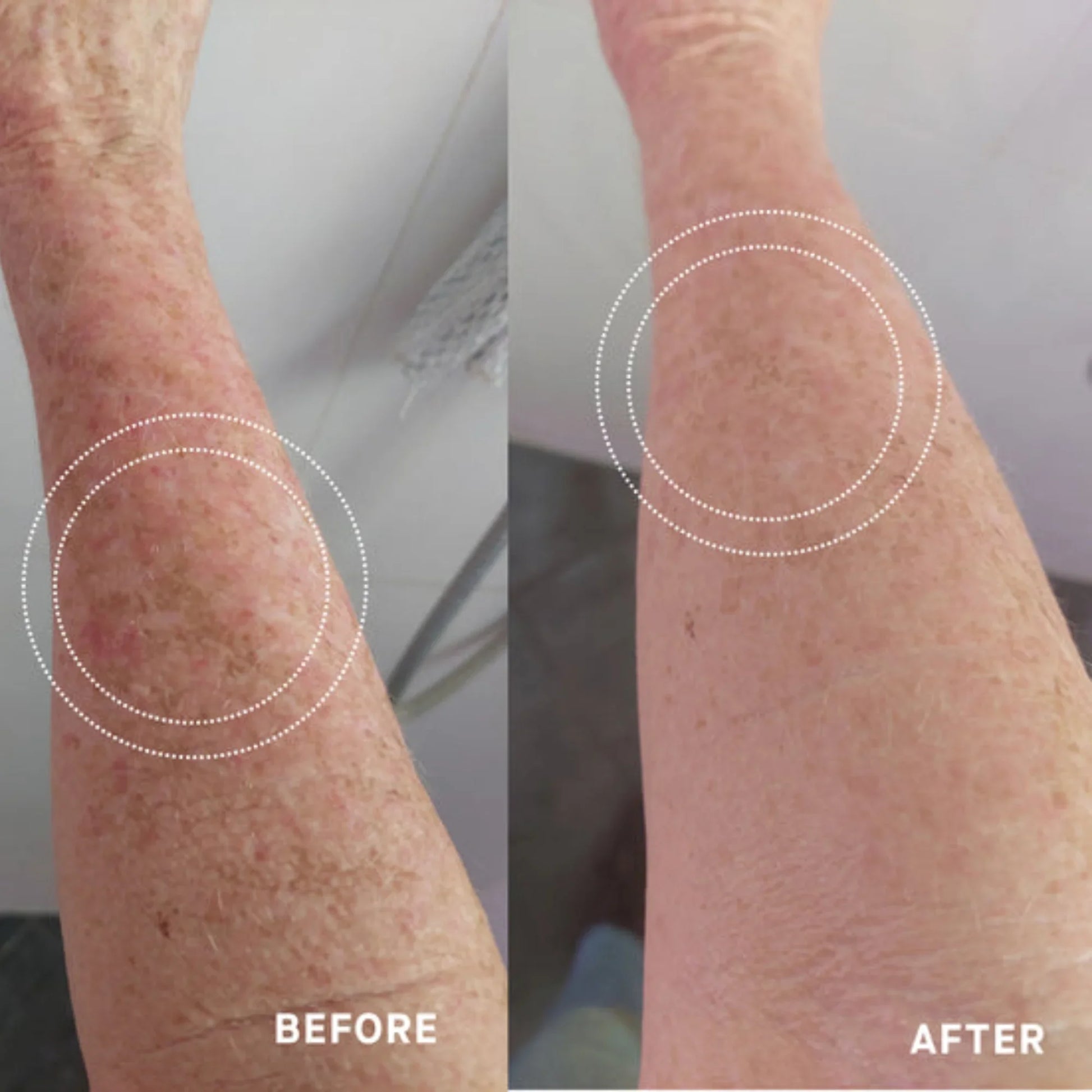 One Skin OS-01 Body Topical Supplement Essential Moisturizer