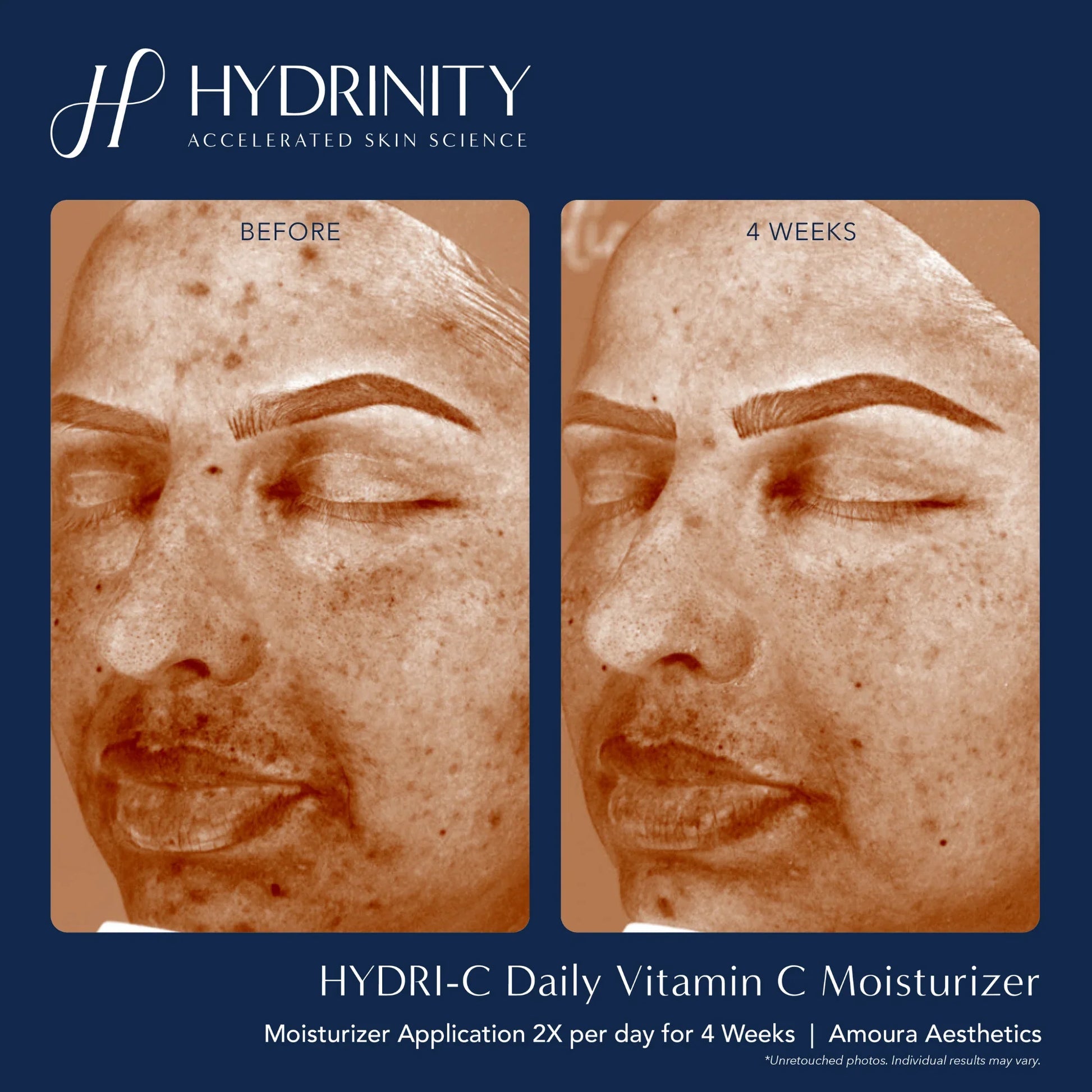 HYDRI-C Daily Vitamin C Moisturizer - MariposaSkincare.com