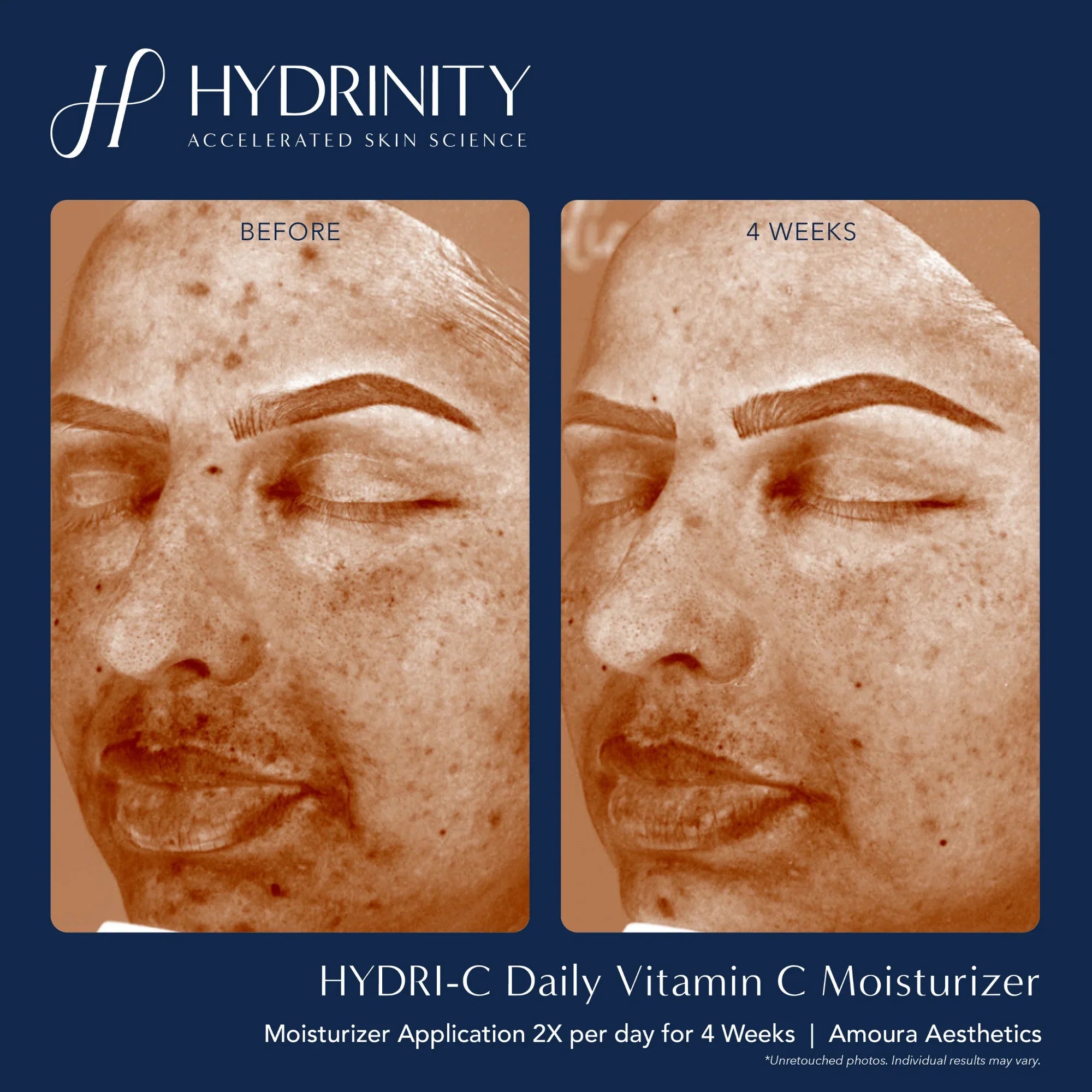 HYDRI-C Daily Vitamin C Moisturizer - MariposaSkincare.com