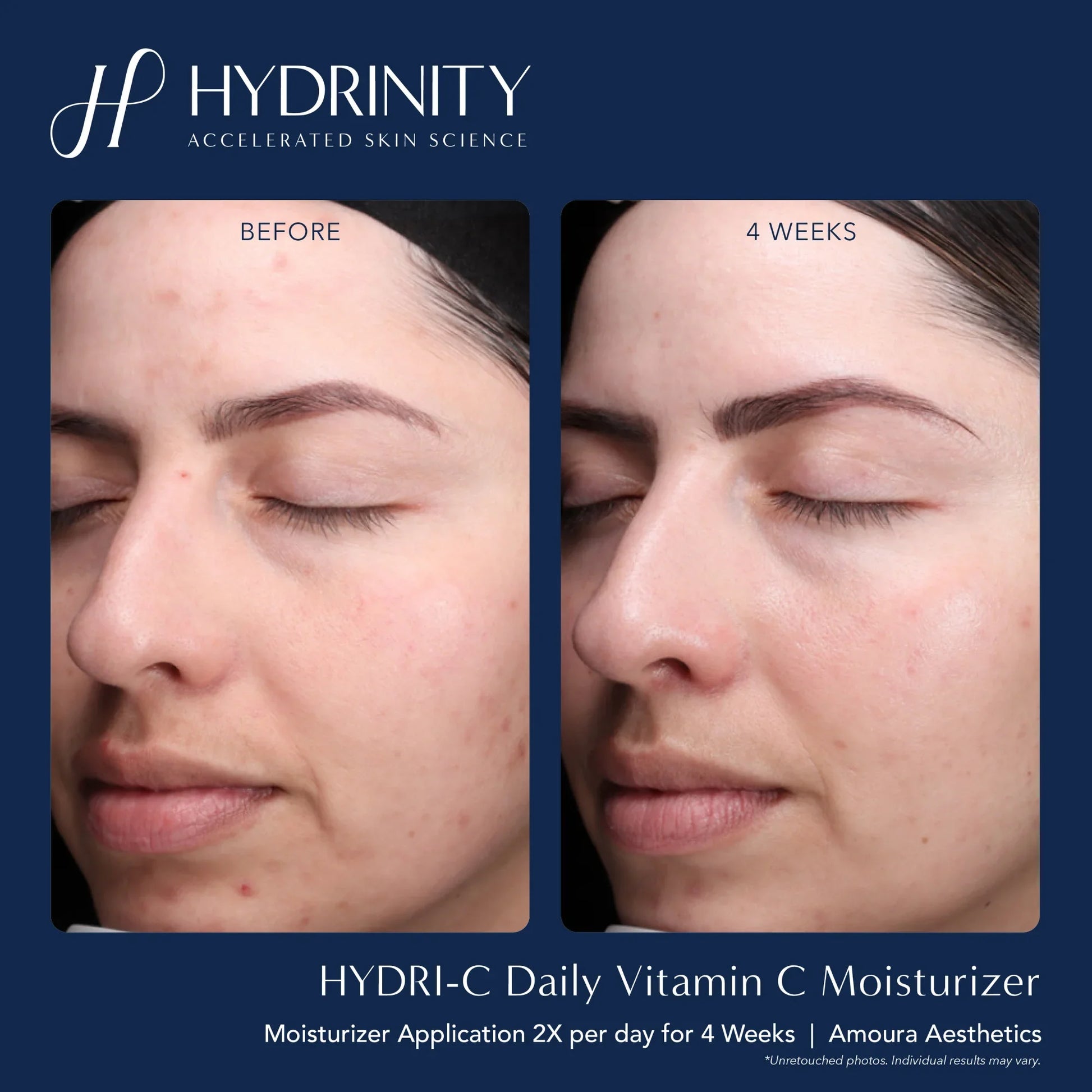 HYDRI-C Daily Vitamin C Moisturizer - MariposaSkincare.com