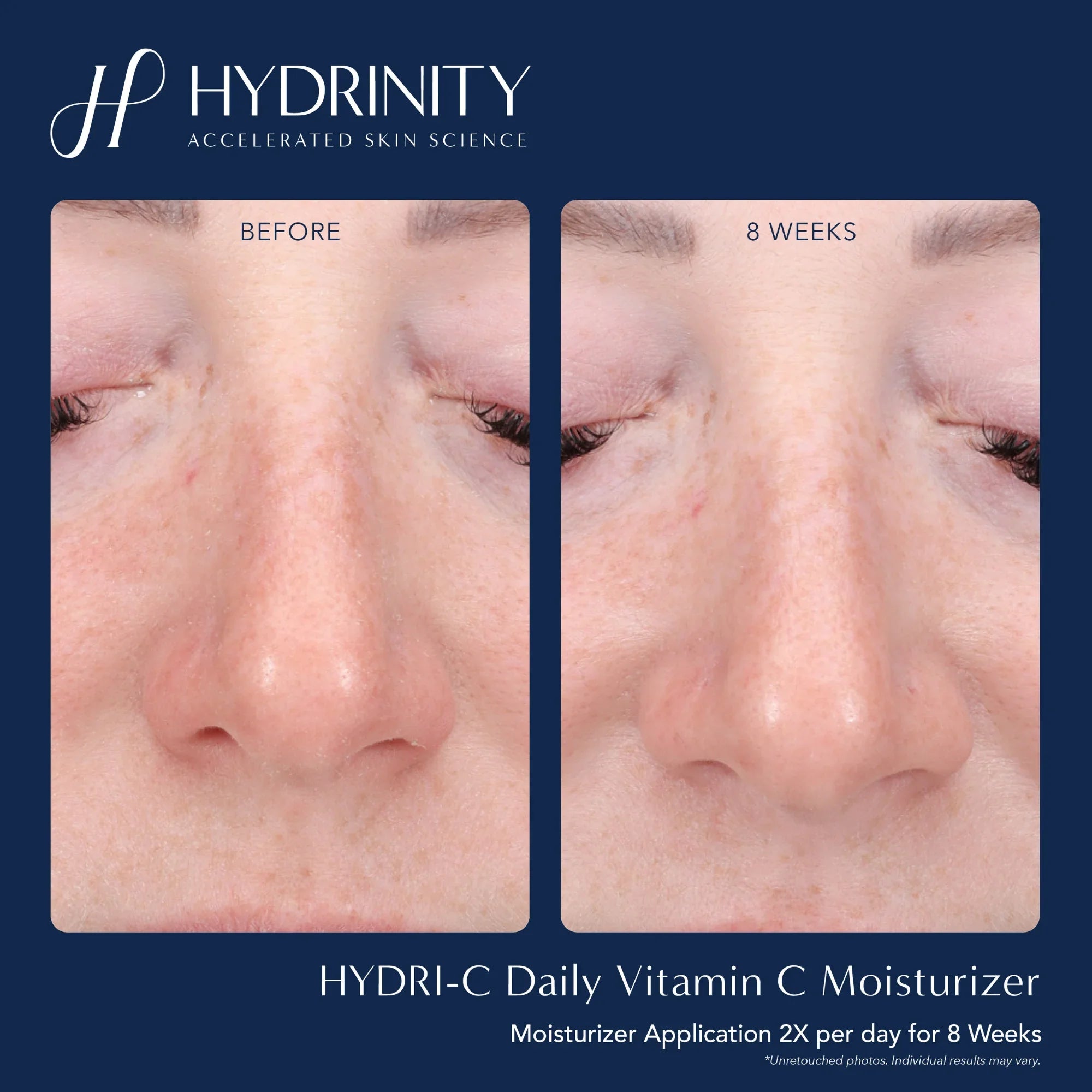 HYDRI-C Daily Vitamin C Moisturizer - MariposaSkincare.com