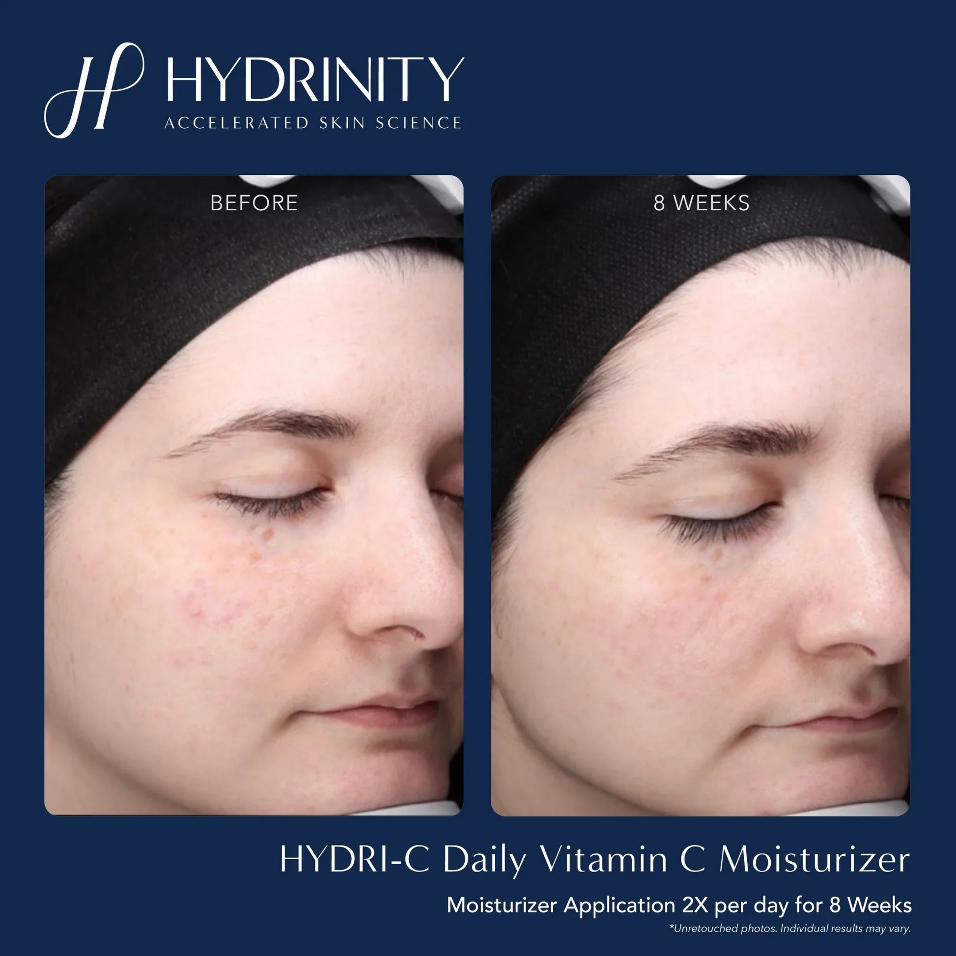 HYDRI-C Daily Vitamin C Moisturizer - MariposaSkincare.com