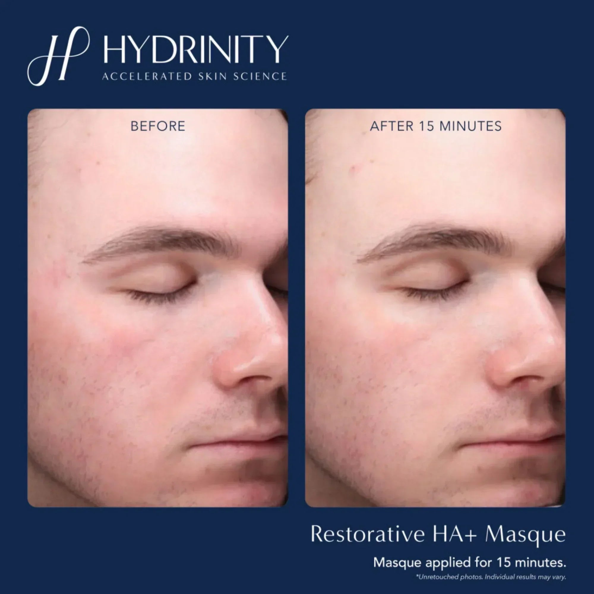 Hydrinity Restorative HA+ Masque - Hydrating Facial Sheet Mask