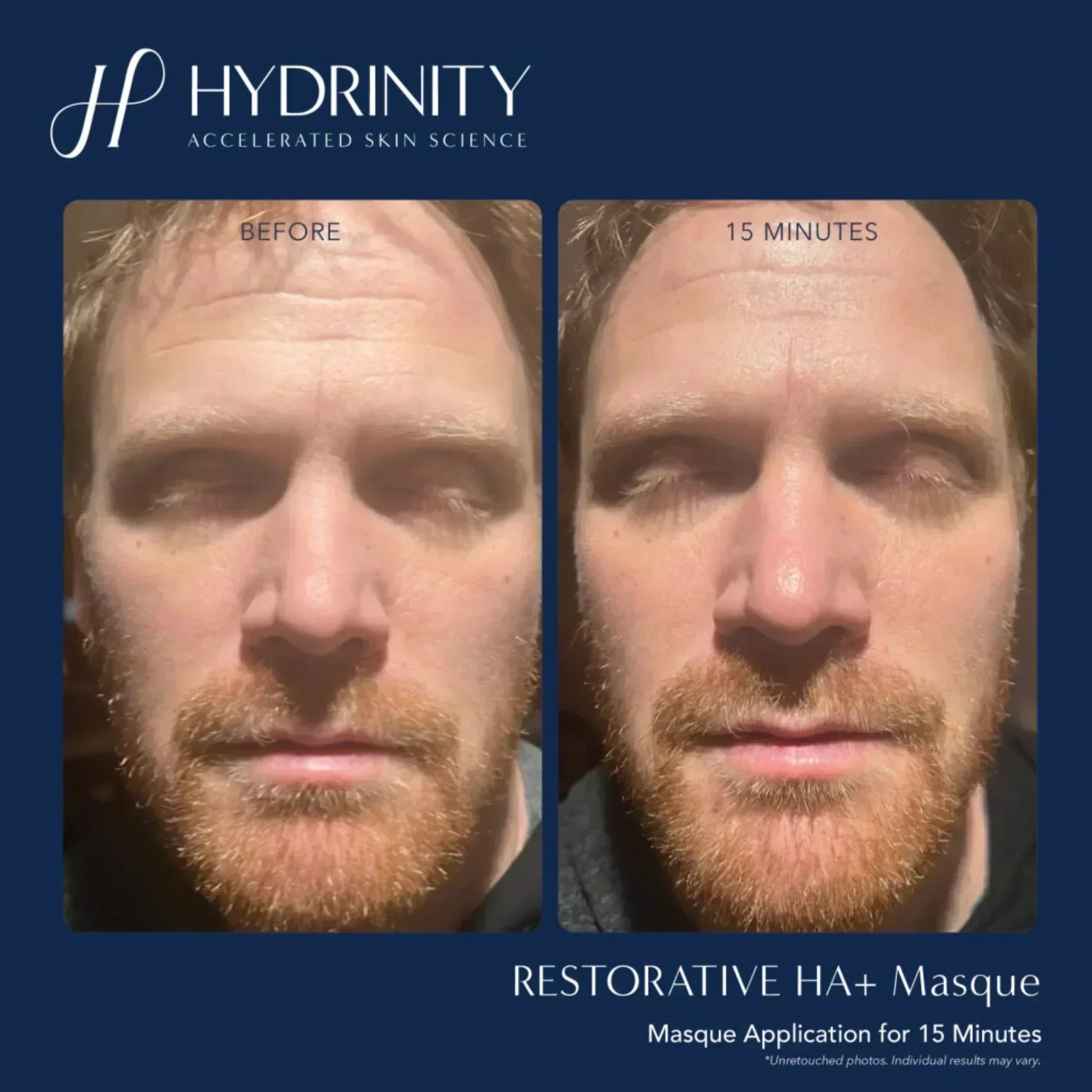 Hydrinity Restorative HA+ Masque - Hydrating Facial Sheet Mask