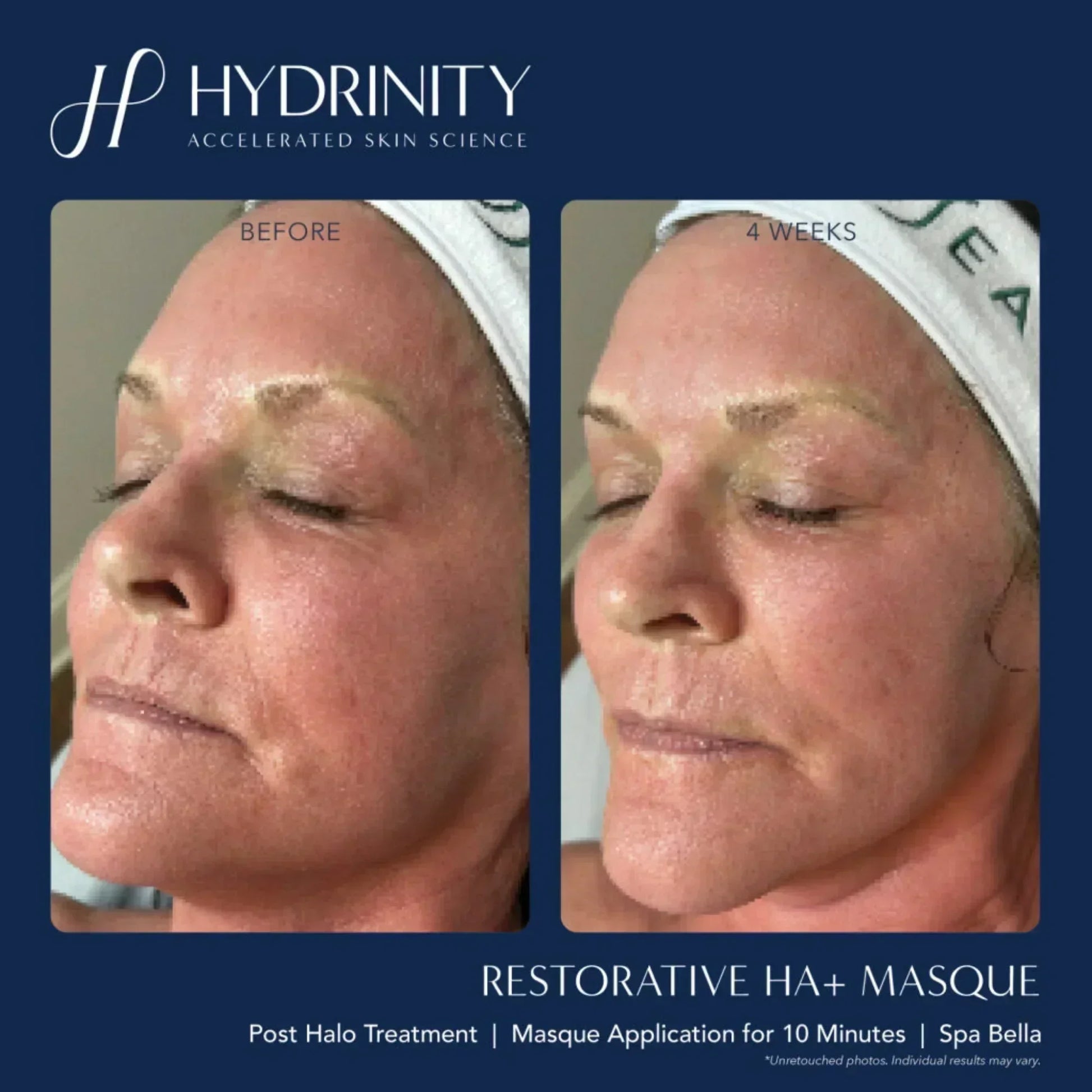 Hydrinity Restorative HA+ Masque - Hydrating Facial Sheet Mask