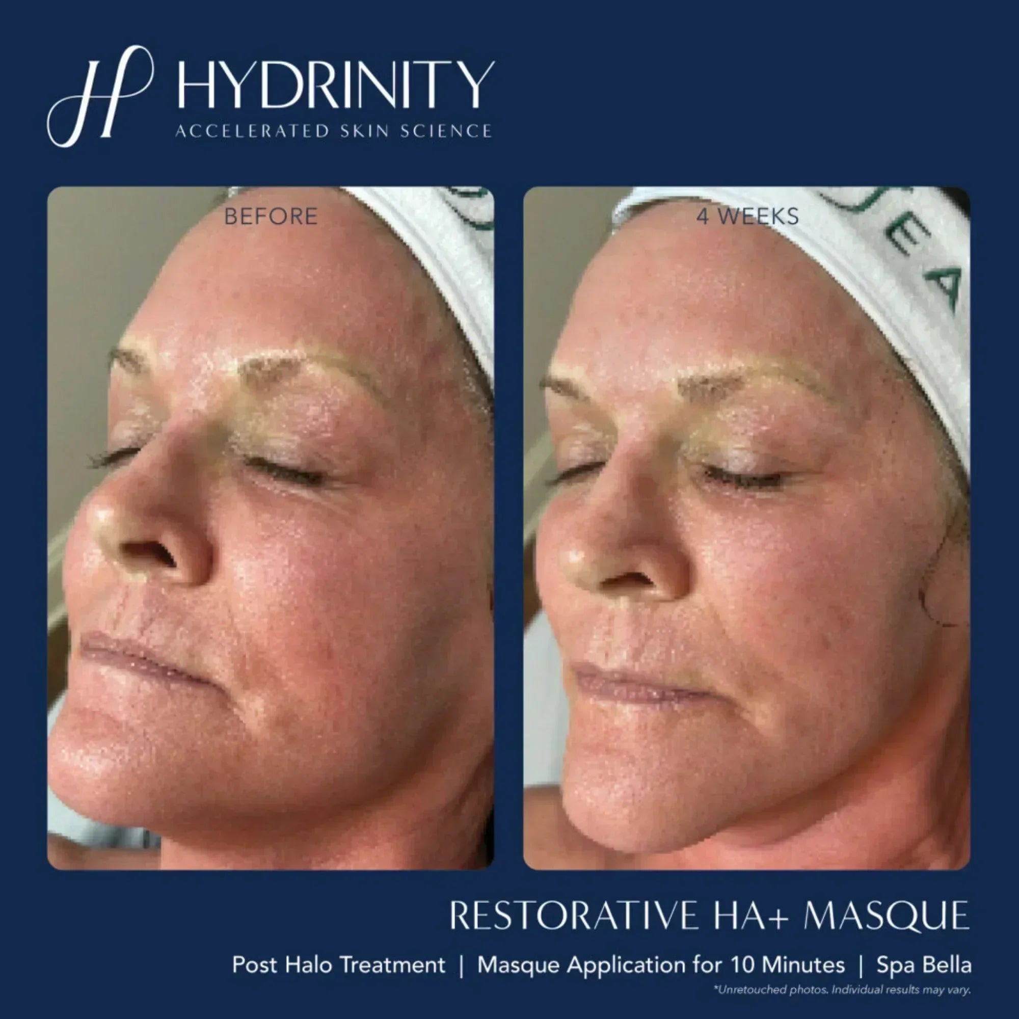 Hydrinity Restorative HA+ Masque - Hydrating Facial Sheet Mask