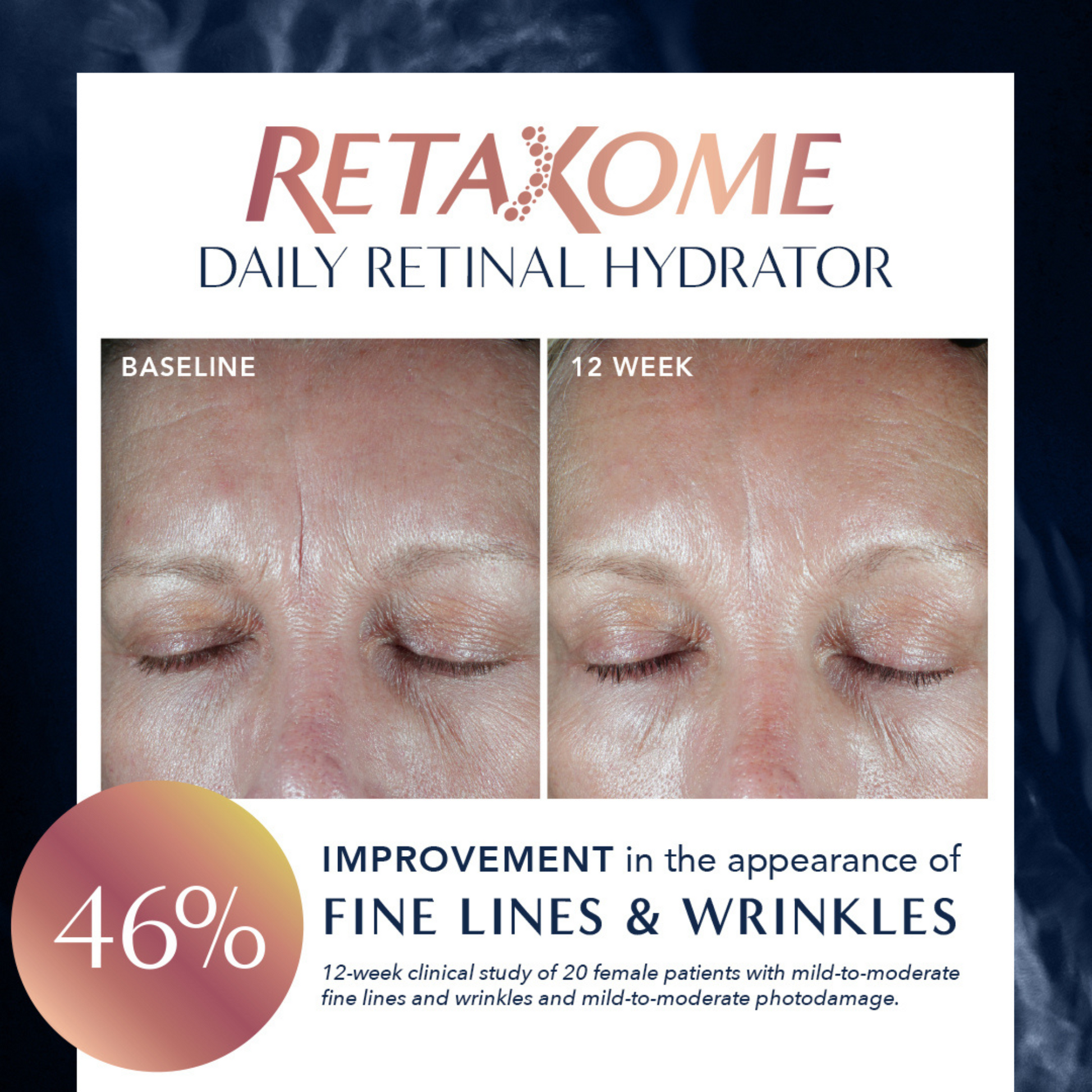 RetaXome™ Daily Retinal Hydrator - MariposaSkincare.com