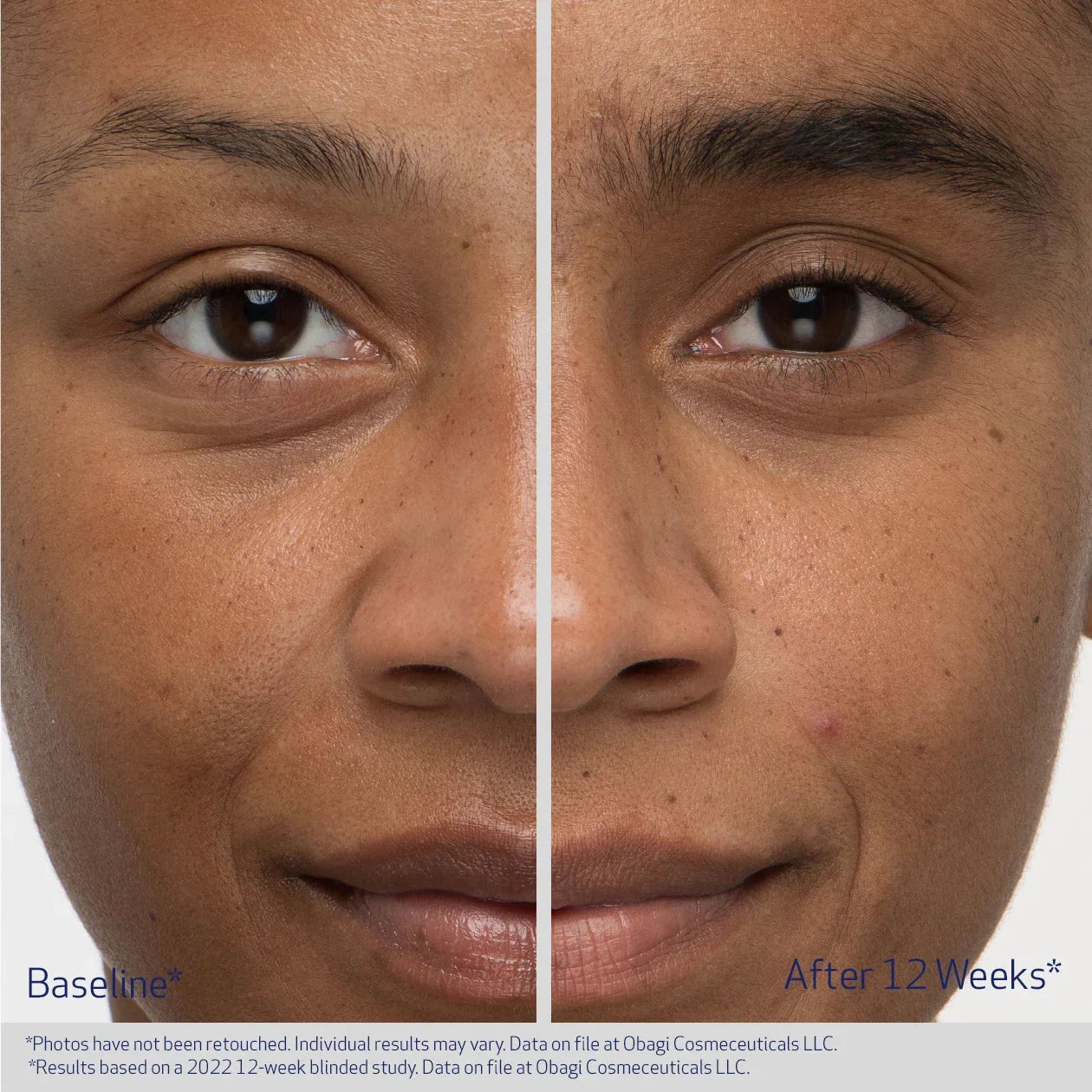 Obagi Medical NU-CIL Eyebrow Boosting Serum