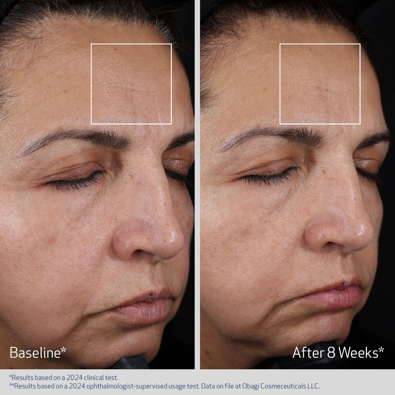 Obagi Medical ElastiDerm Advanced Filler Concentrate