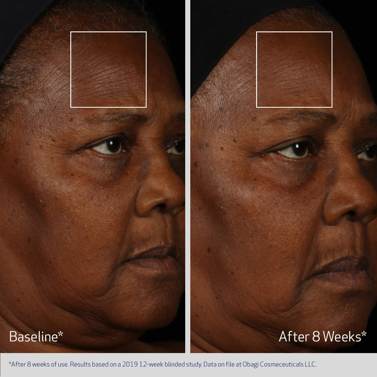 Obagi Medical ElastiDerm Facial Serum