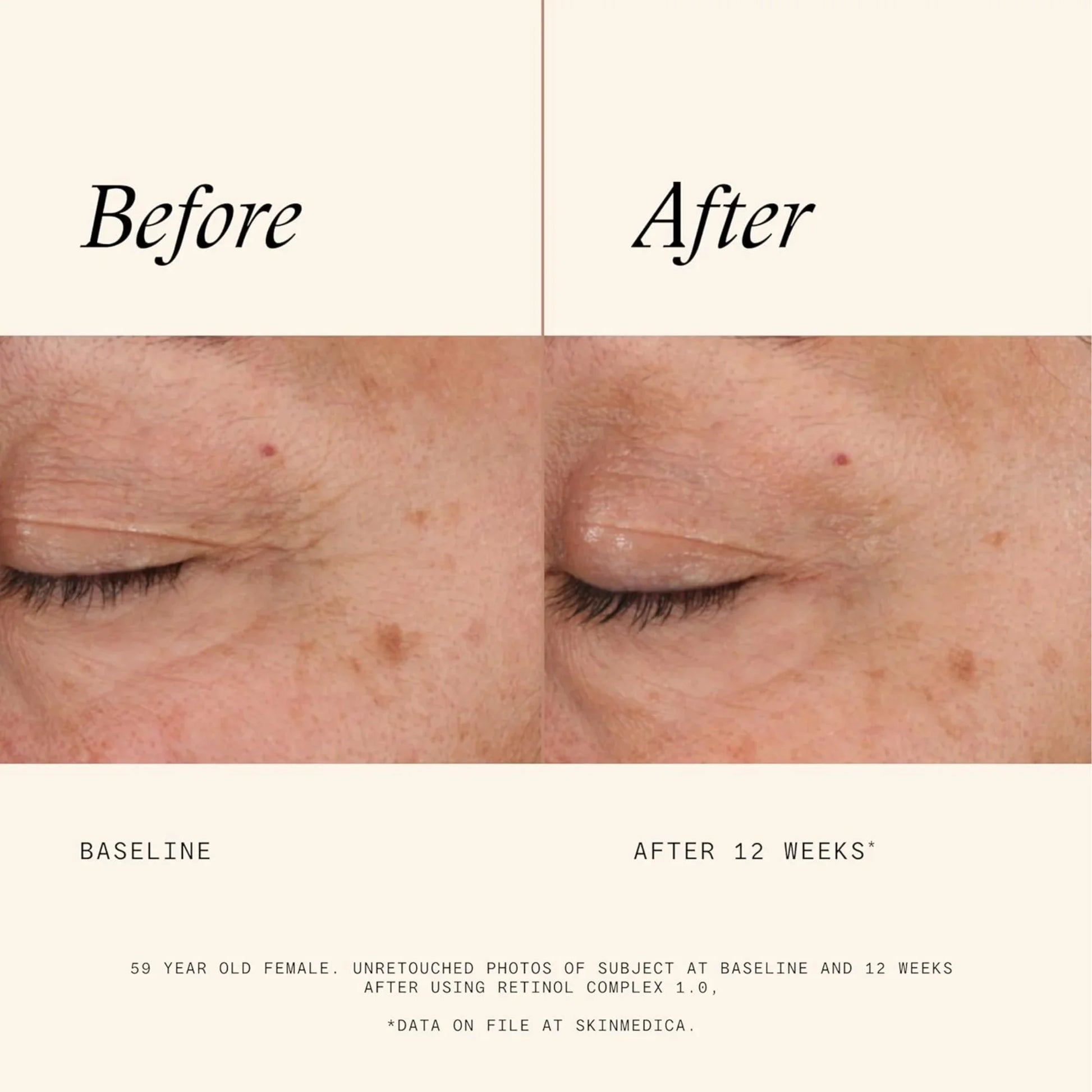 Retinol Complex 1.0 - MariposaSkincare.com