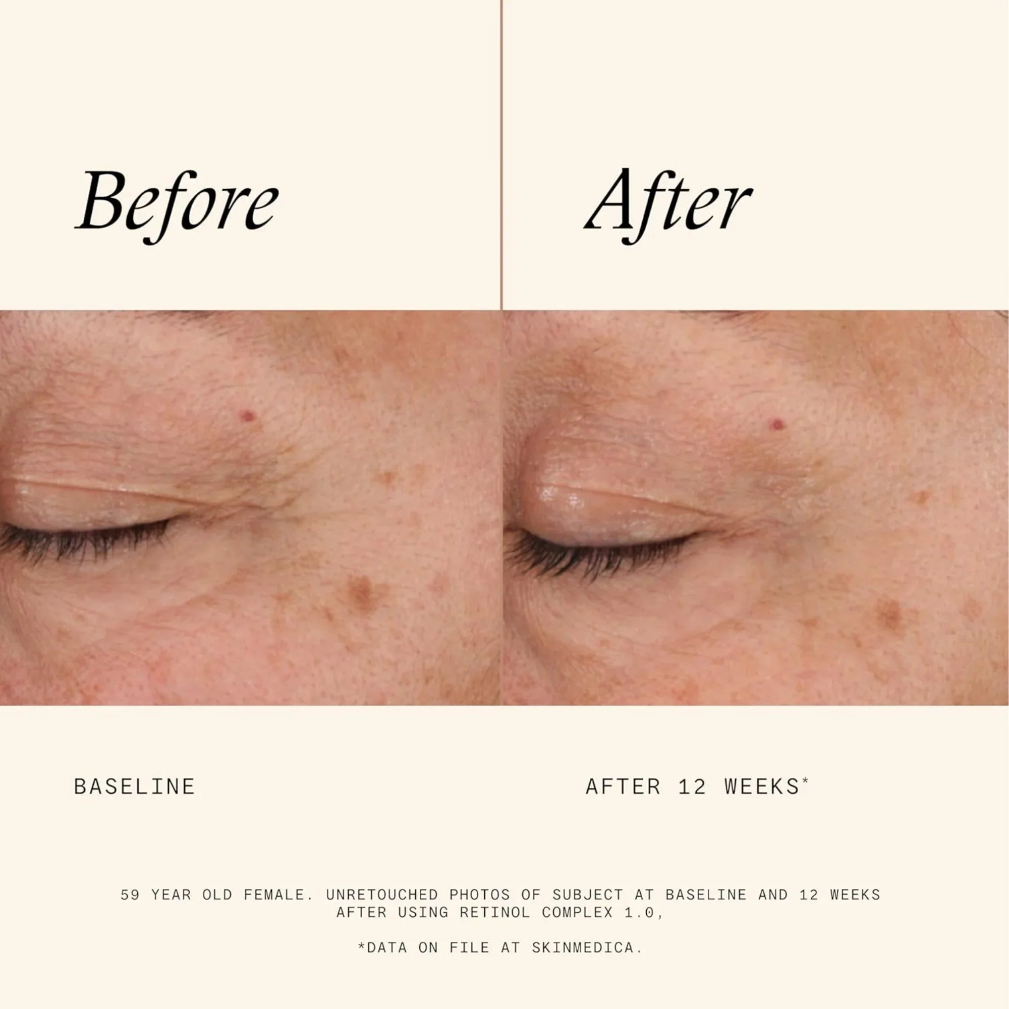 Retinol Complex 1.0 - MariposaSkincare.com