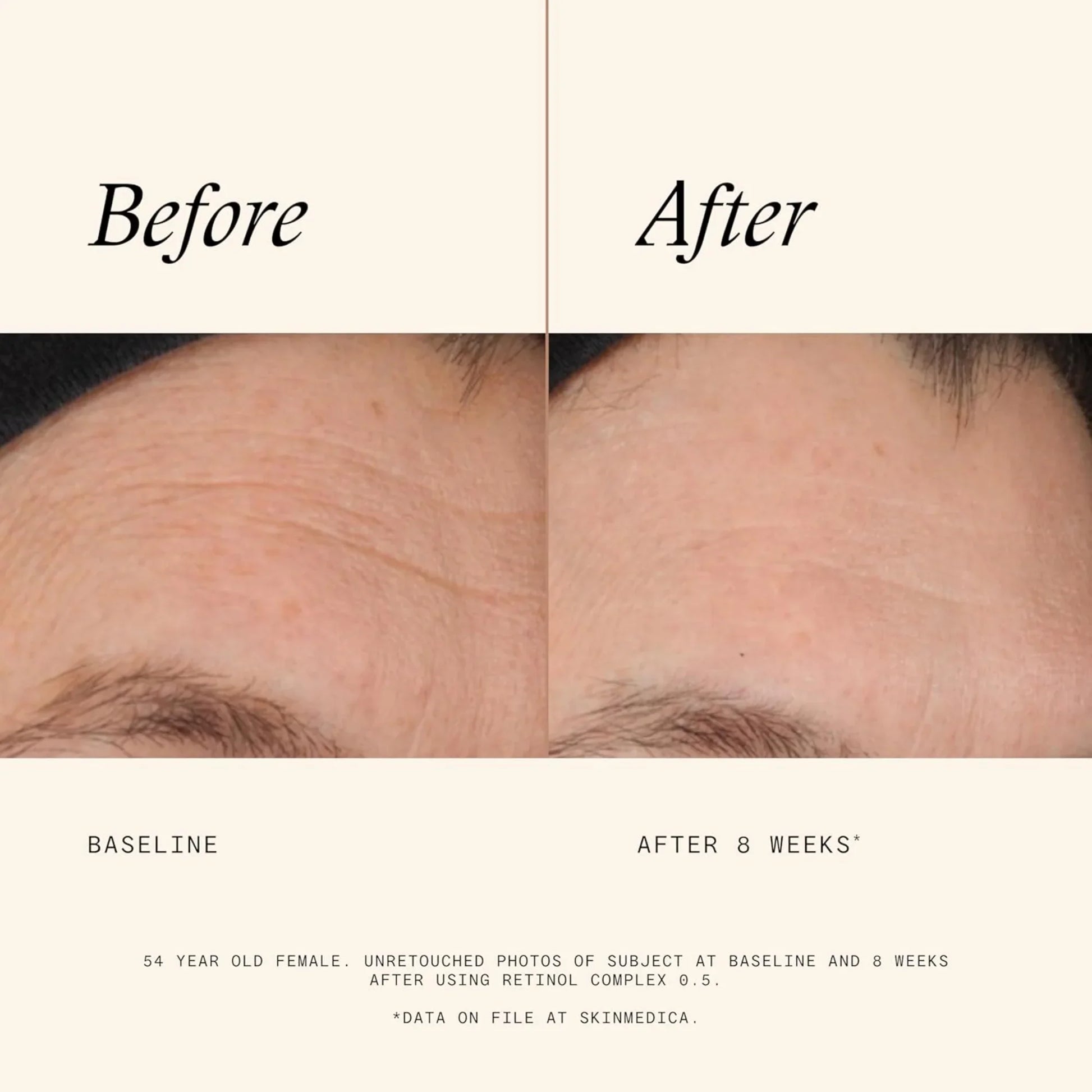 Retinol Complex 0.5 - MariposaSkincare.com