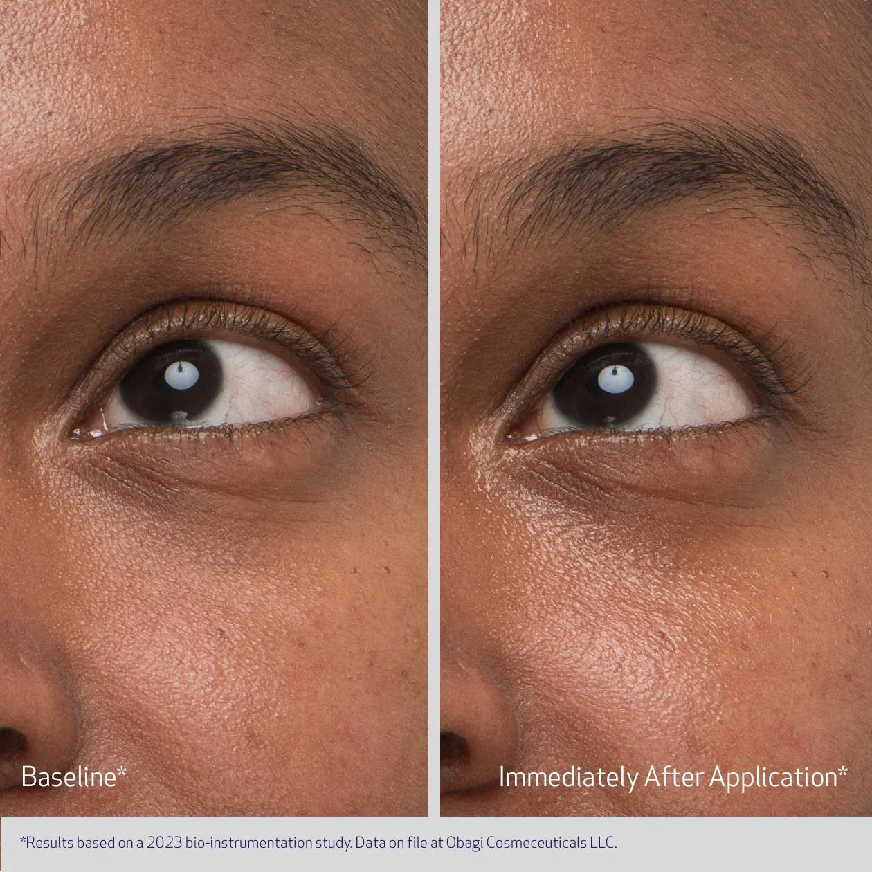 Obagi Medical Daily Hydro-Drops Rejuvenating Eye Gel Cream