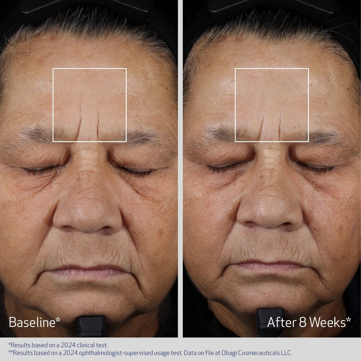 Obagi Medical ElastiDerm Advanced Filler Concentrate