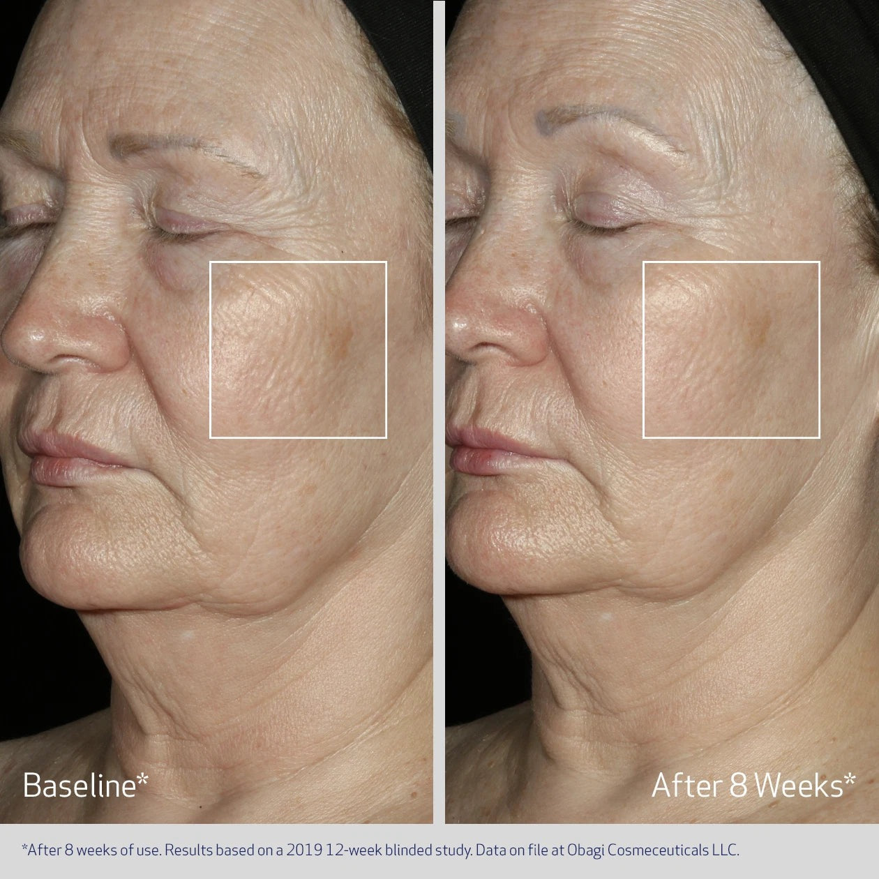 Obagi Medical ElastiDerm Facial Serum