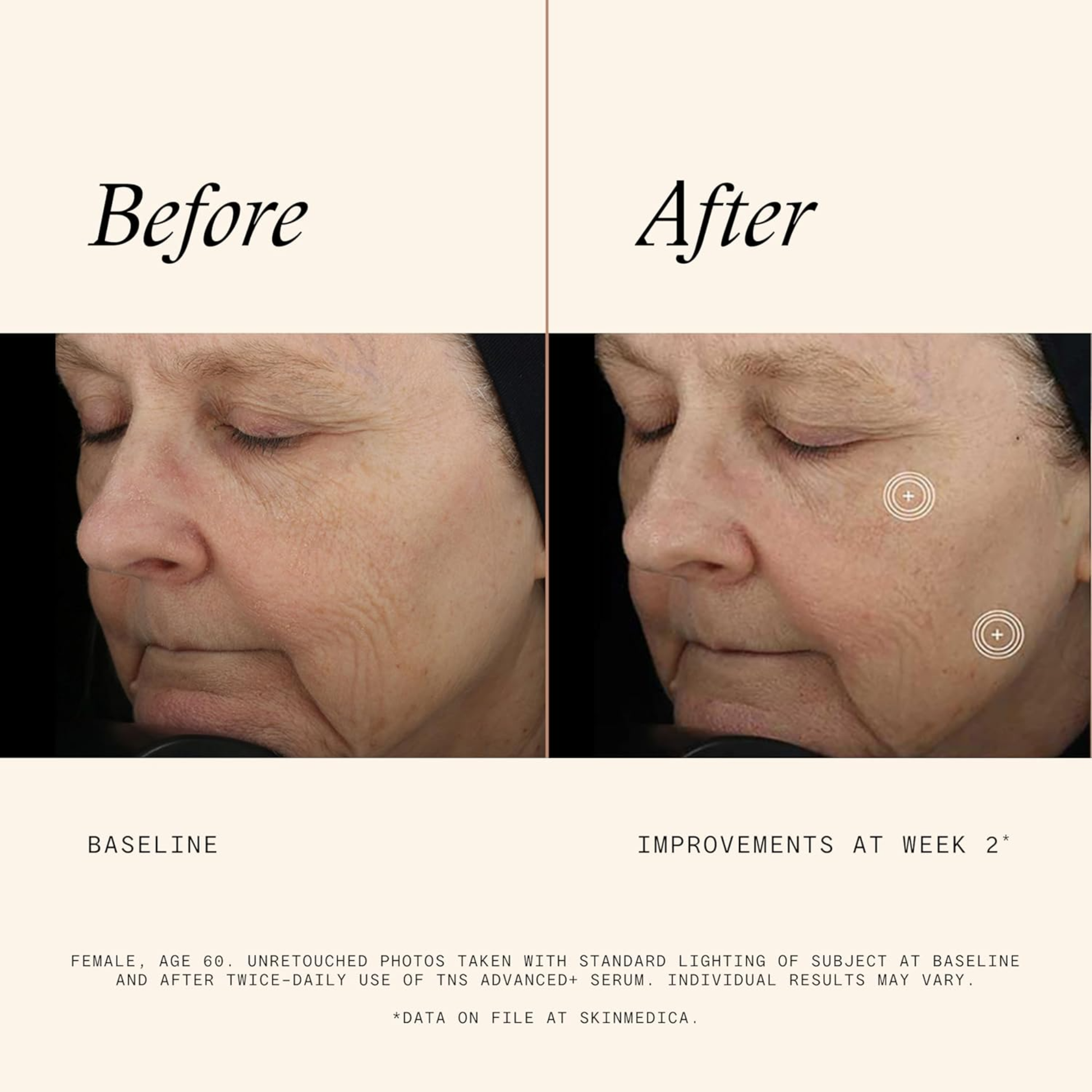 TNS® Advanced+ Serum - MariposaSkincare.com