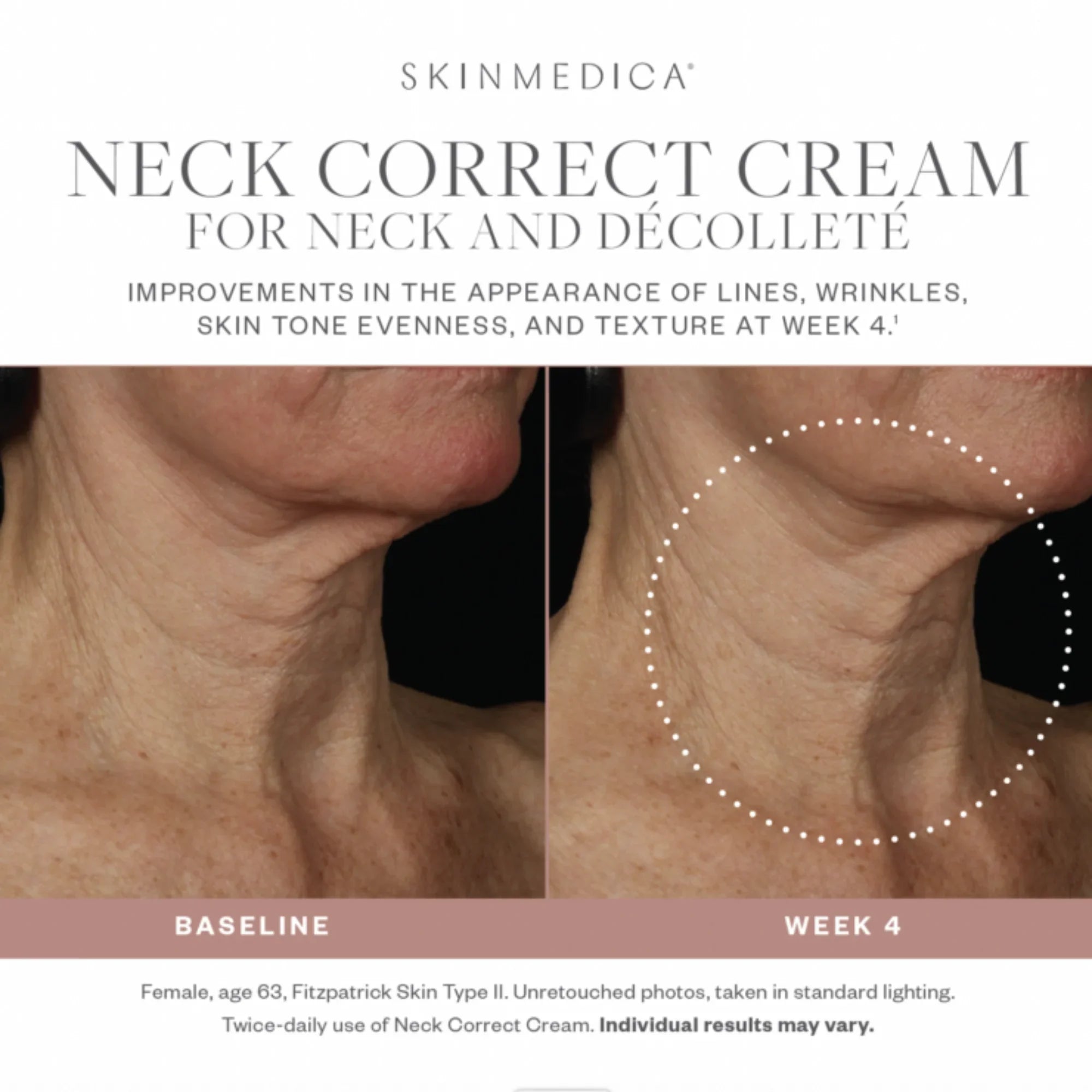 Neck Correct Cream - MariposaSkincare.com