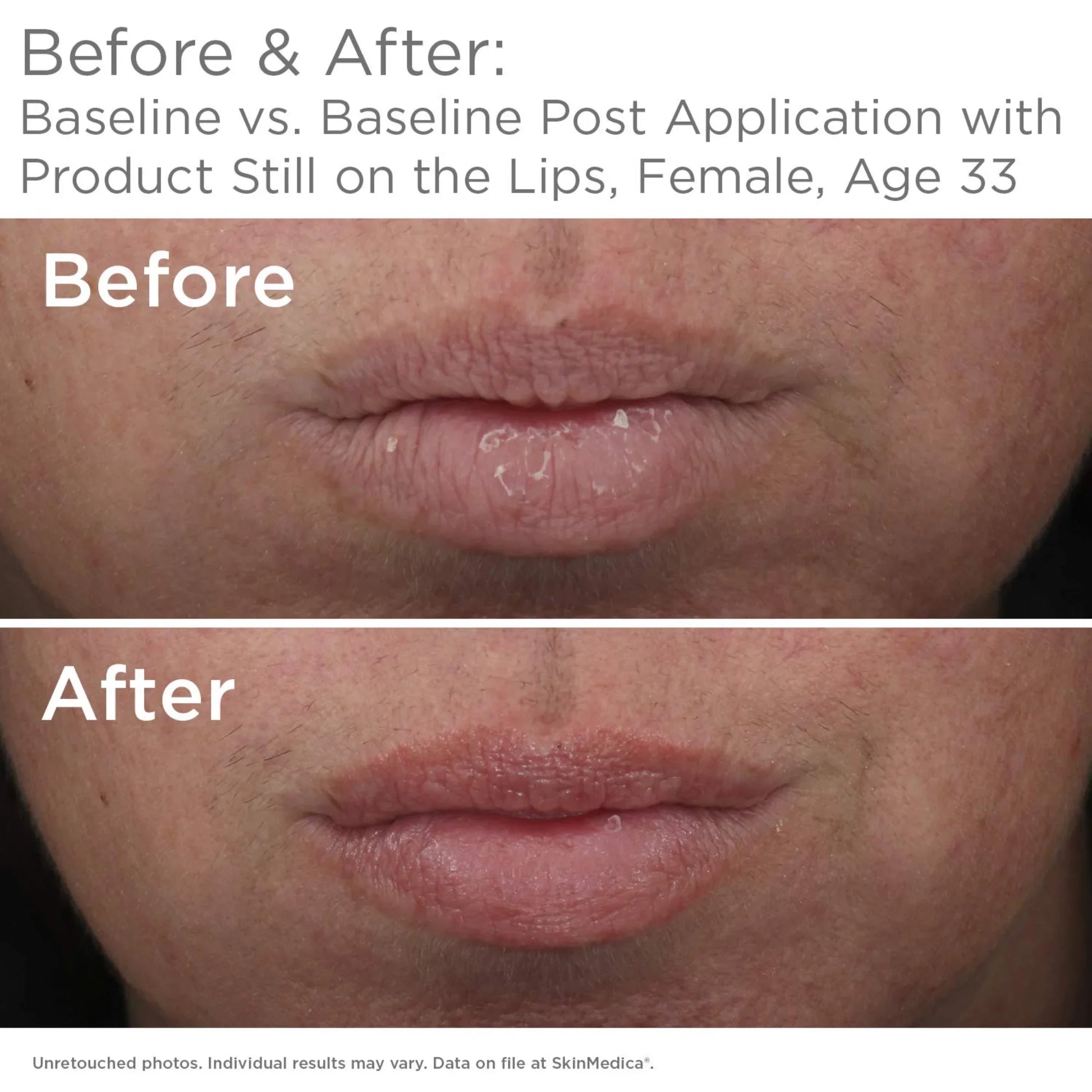 HA⁵® Smooth and Plump Lip System - MariposaSkincare.com