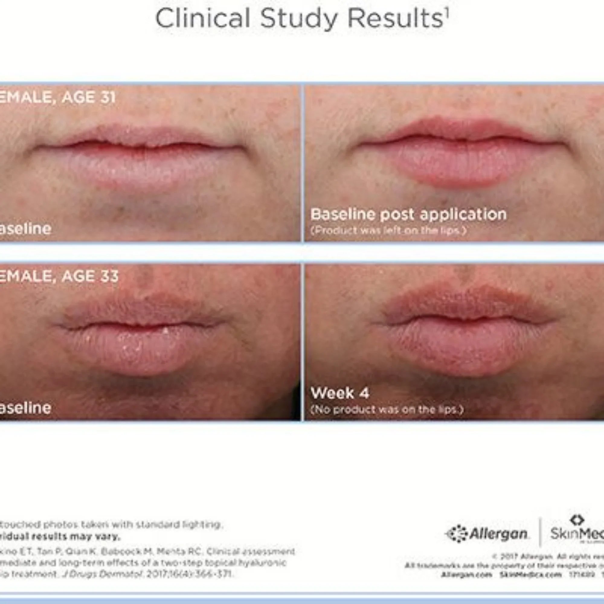 HA⁵® Smooth and Plump Lip System - MariposaSkincare.com