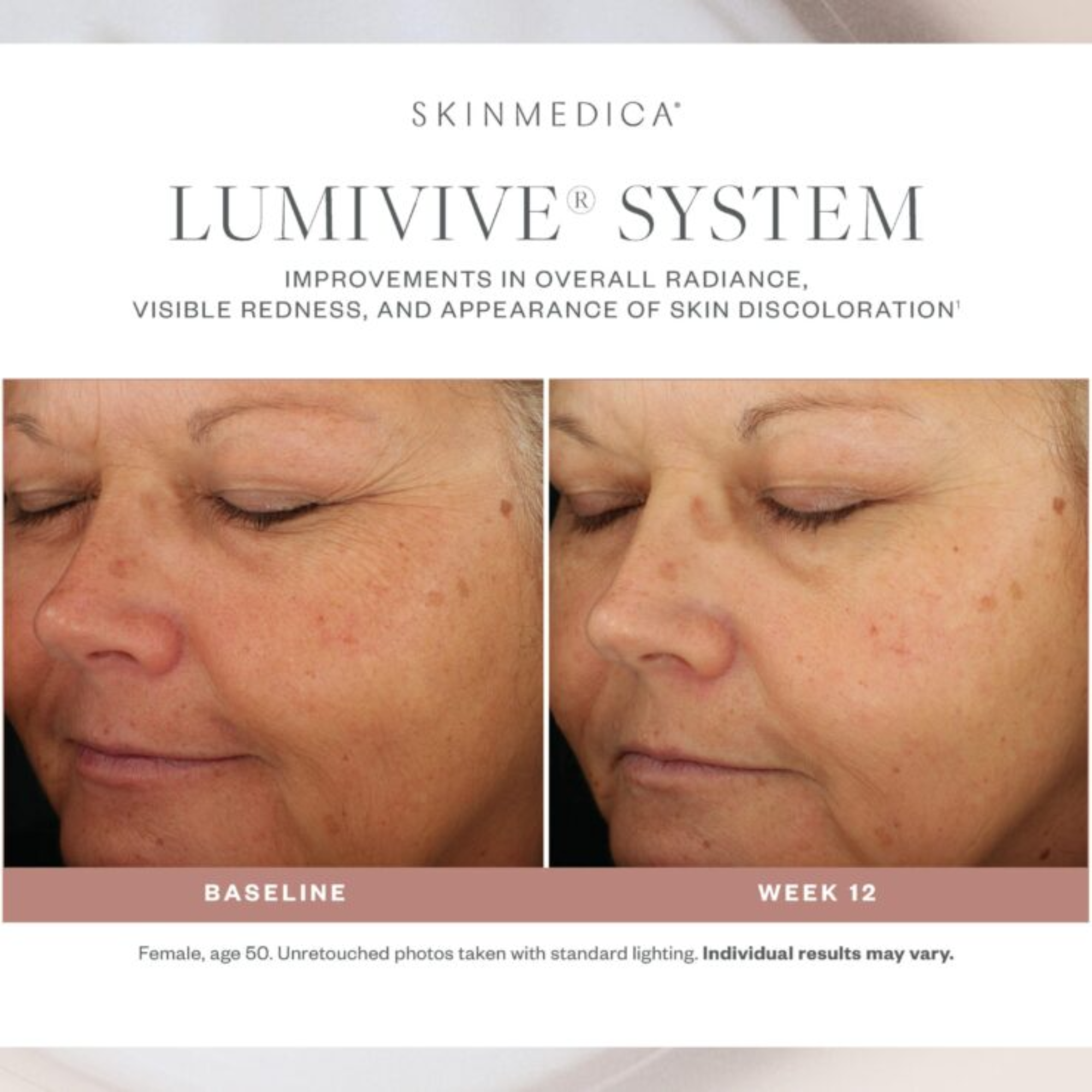 LUMIVIVE® System - MariposaSkincare.com