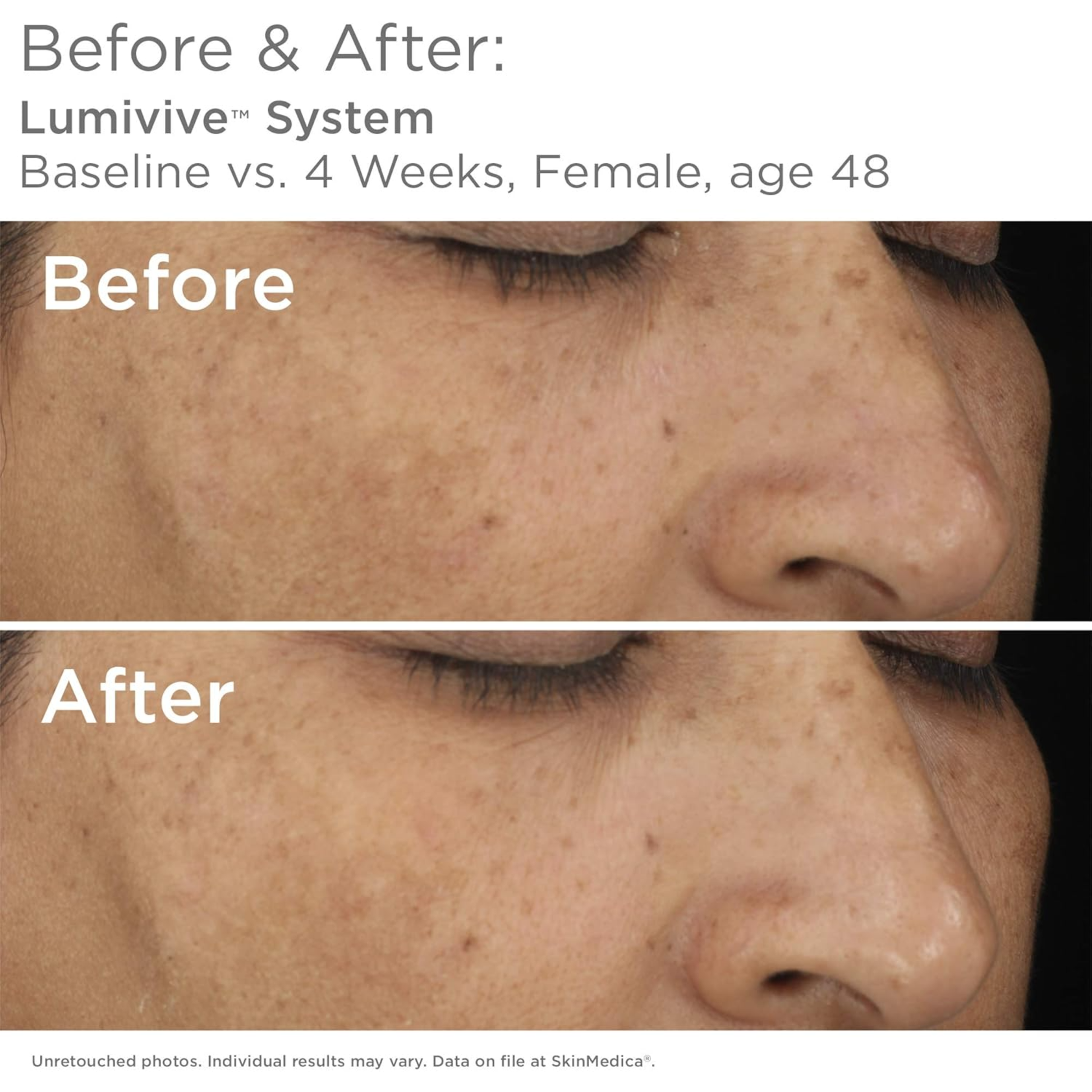 LUMIVIVE® System - MariposaSkincare.com