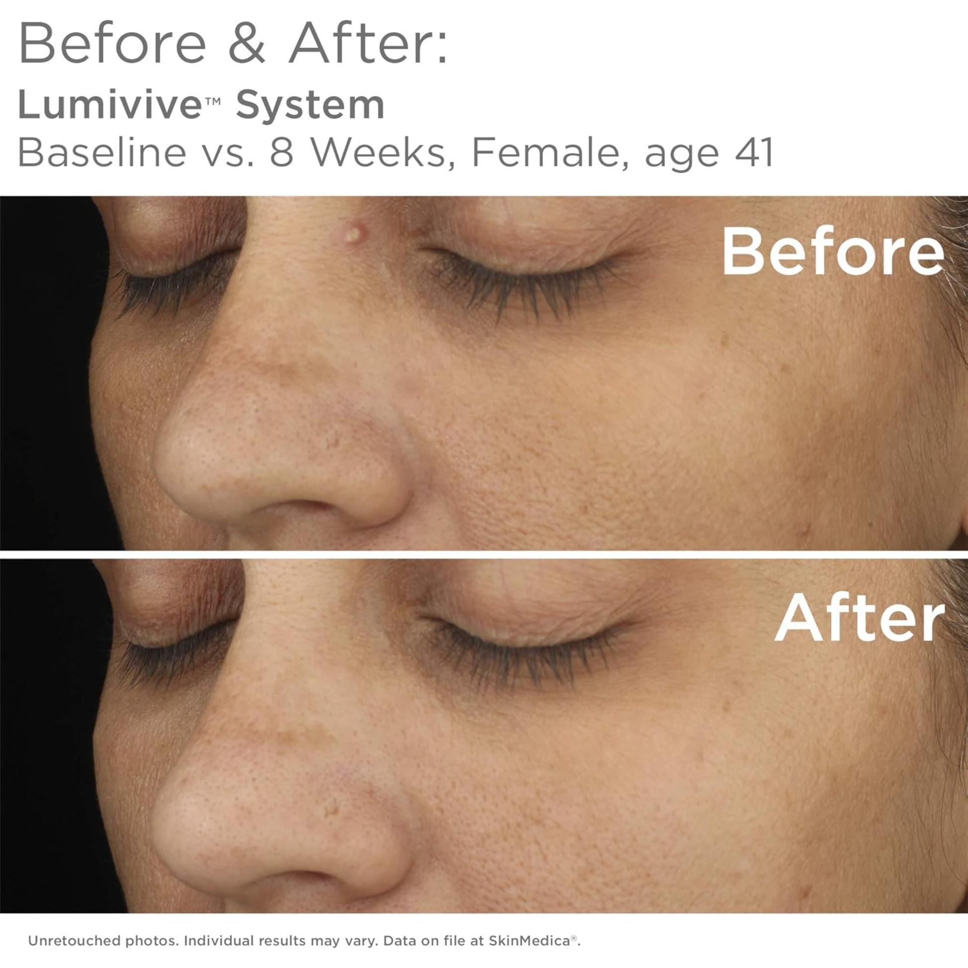 LUMIVIVE® System - MariposaSkincare.com