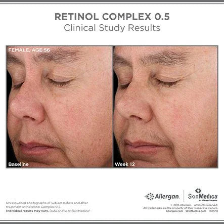Retinol Complex 0.5 - MariposaSkincare.com