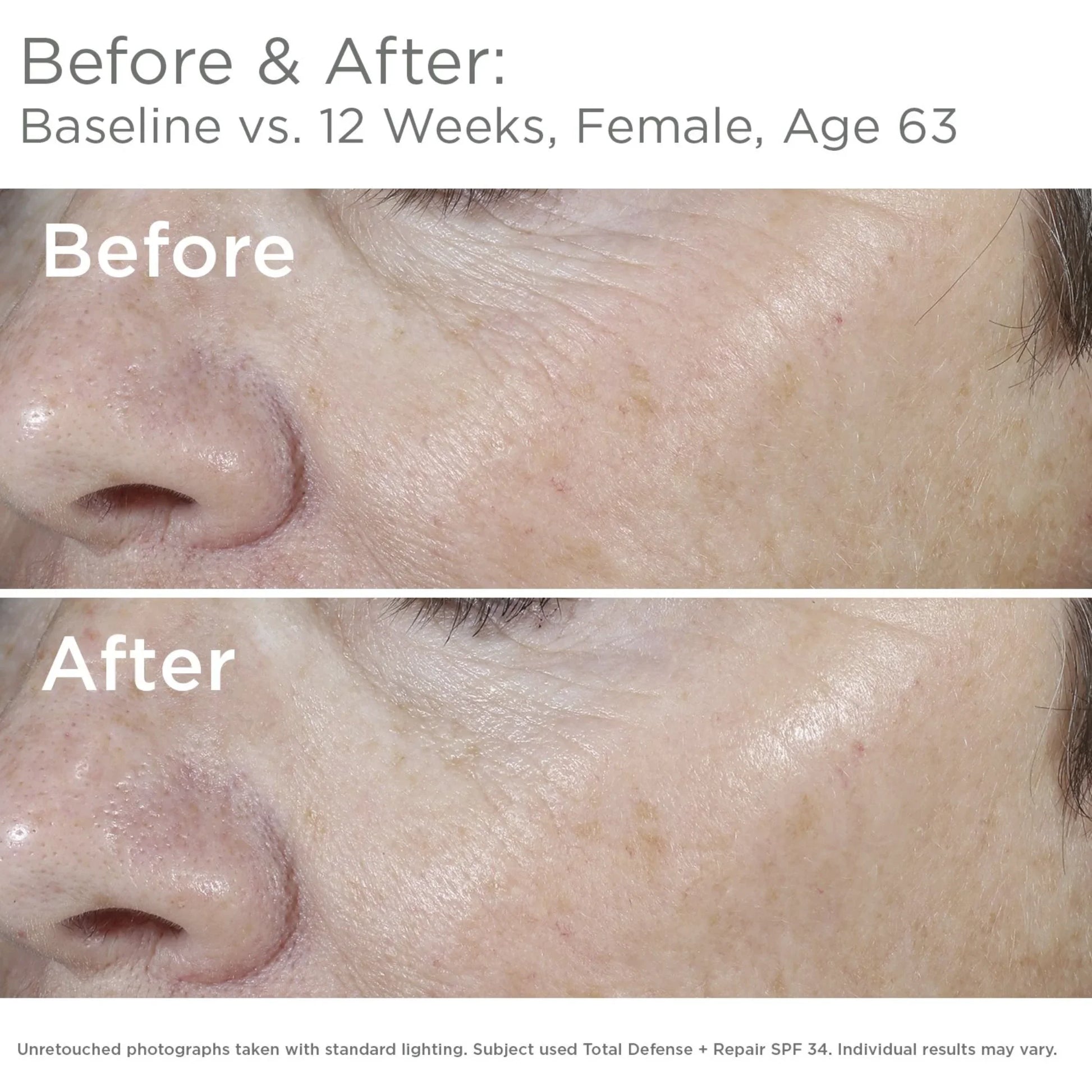 SkinMedica® Total Defense Repair SPF 34 Sunscreen
