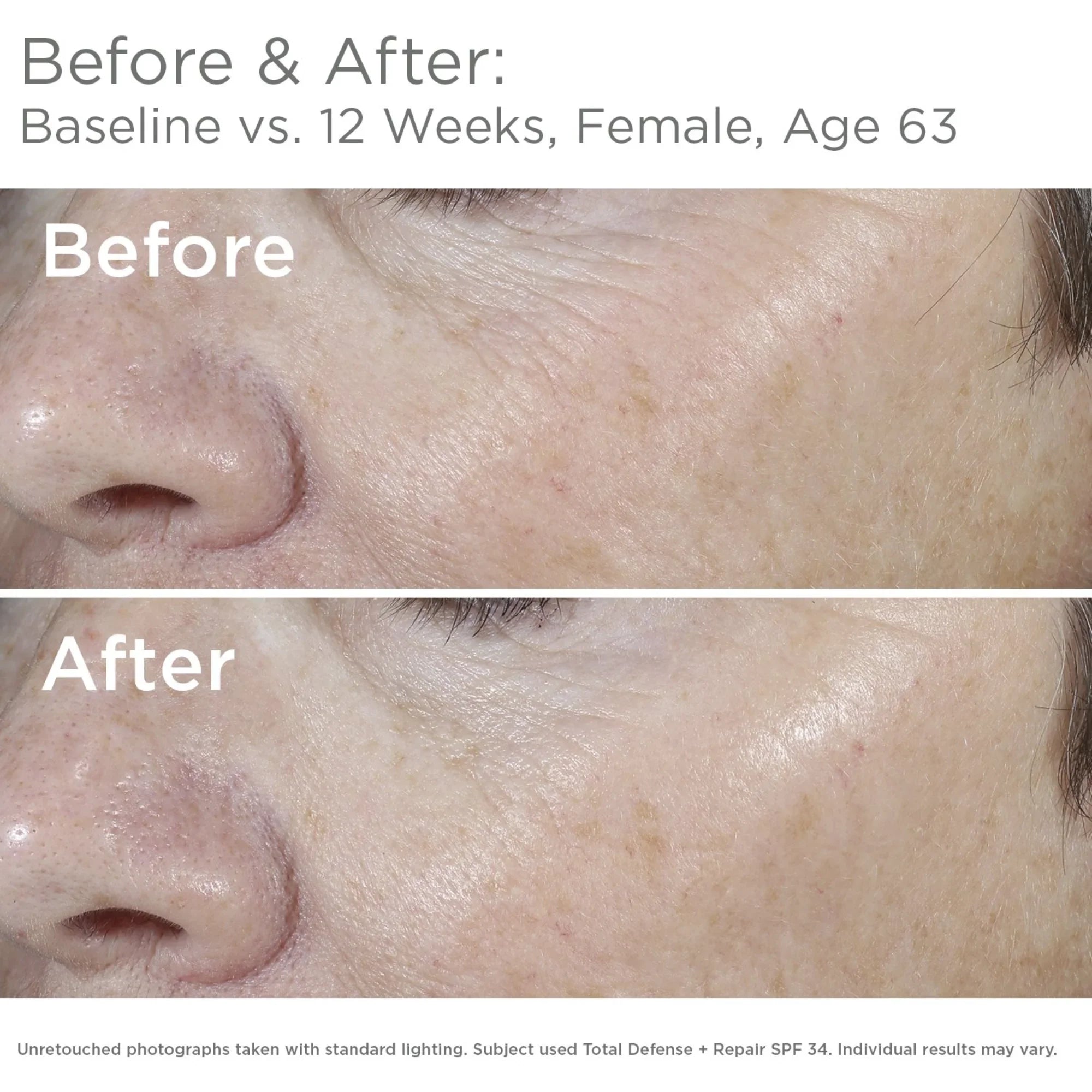 SkinMedica® Total Defense Repair SPF 34 Sunscreen