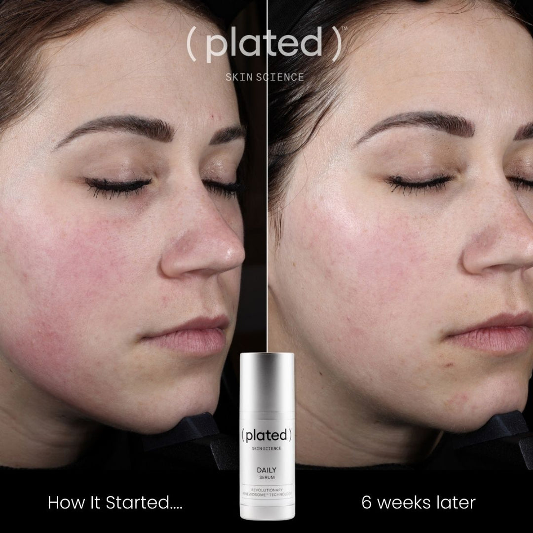 ( plated )™ Daily Skincare Serum for Radiant Skin