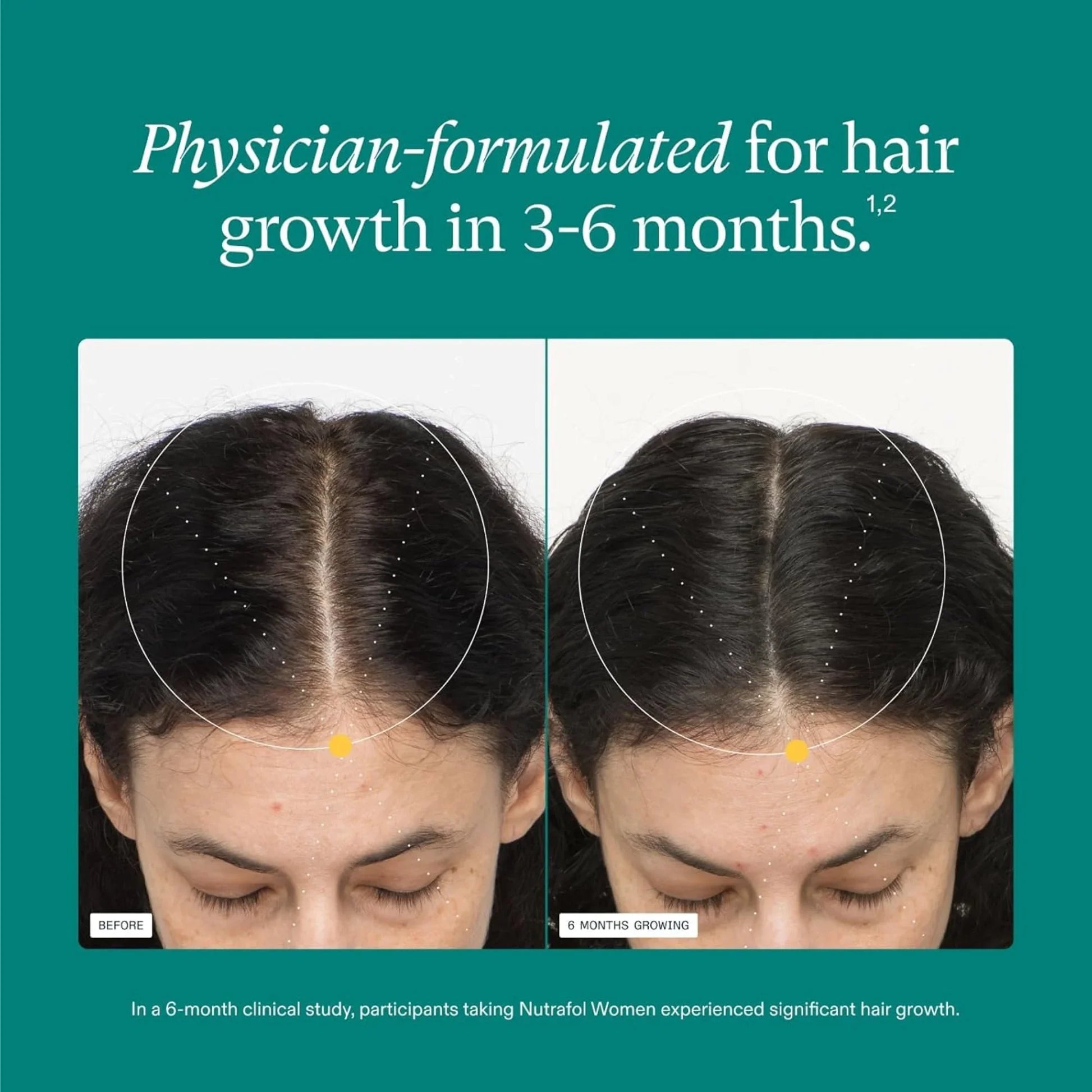 WOMEN Hair Growth Supplements, for Women 18-44 Years Old, Dermatologist Recommended - MariposaSkincare.com