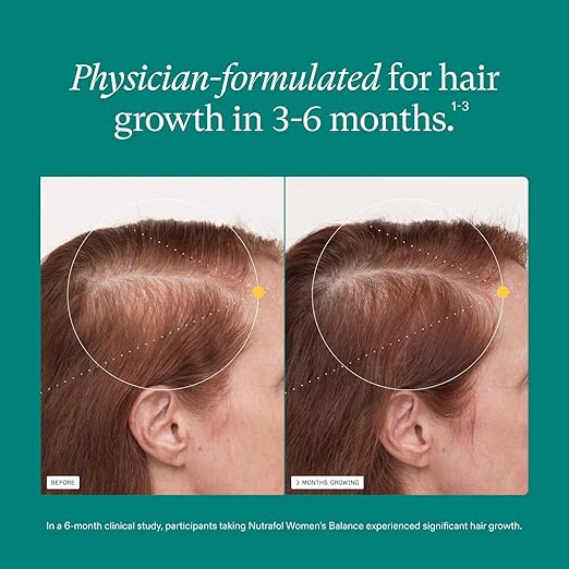 WOMEN'S BALANCE Hair Growth Supplements, 3 MONTH SUPPLY, Ages 45 and Up, Dermatologist Recommended - MariposaSkincare.com