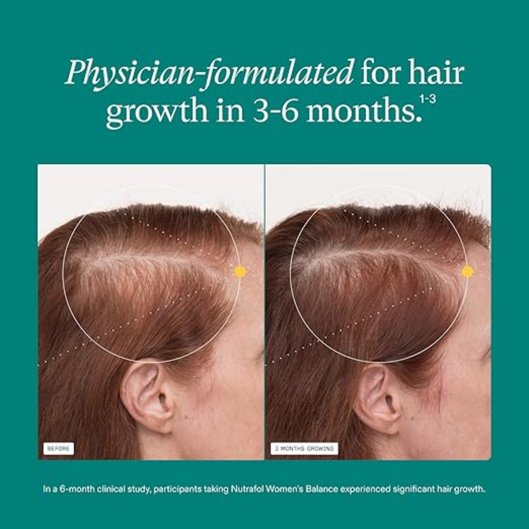 WOMEN'S BALANCE Hair Growth Supplements, 3 MONTH SUPPLY, Ages 45 and Up, Dermatologist Recommended - MariposaSkincare.com