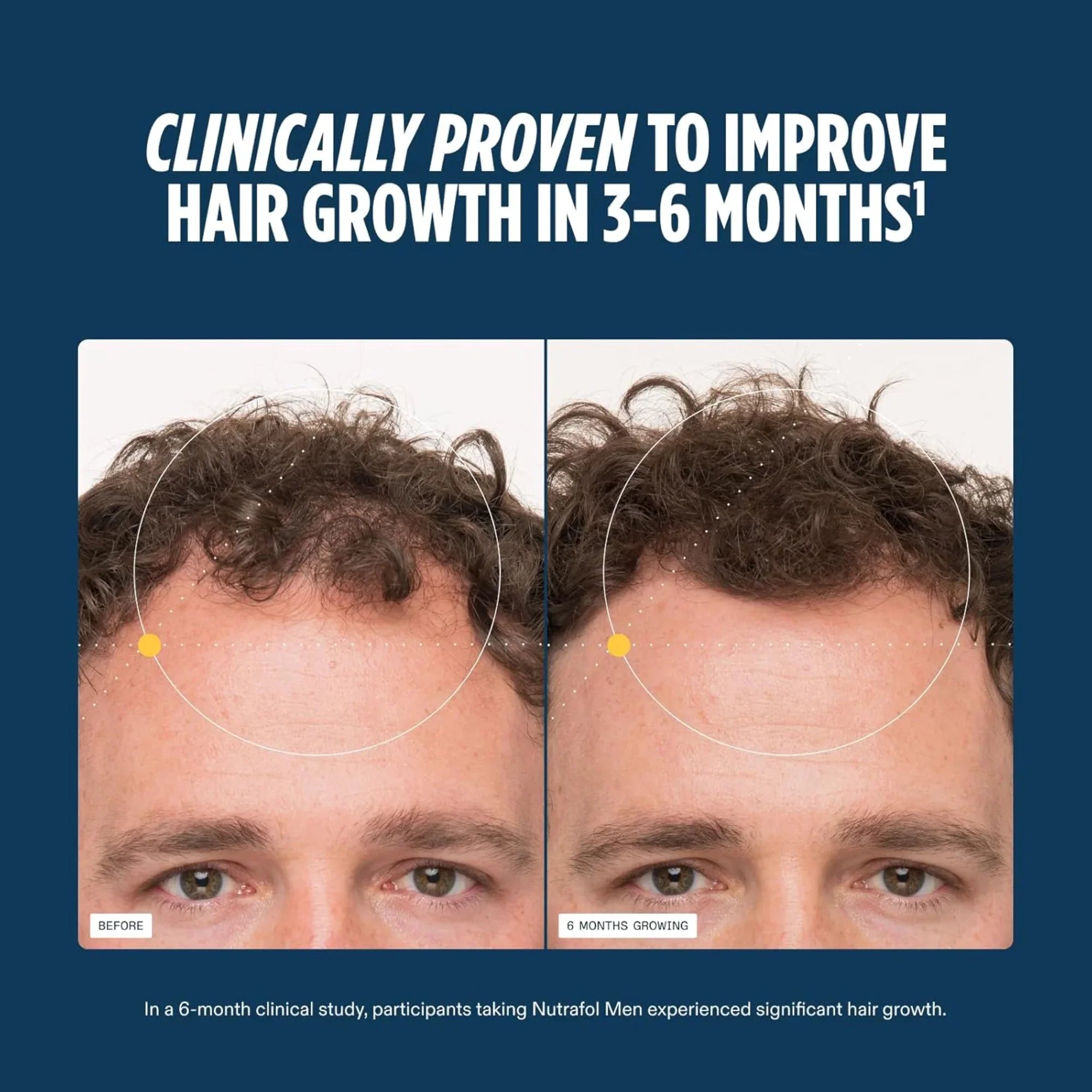 Nutrafol® MEN Hair Growth Supplements - 1 MONTH SUPPLY - Clinically Tested & Effective
