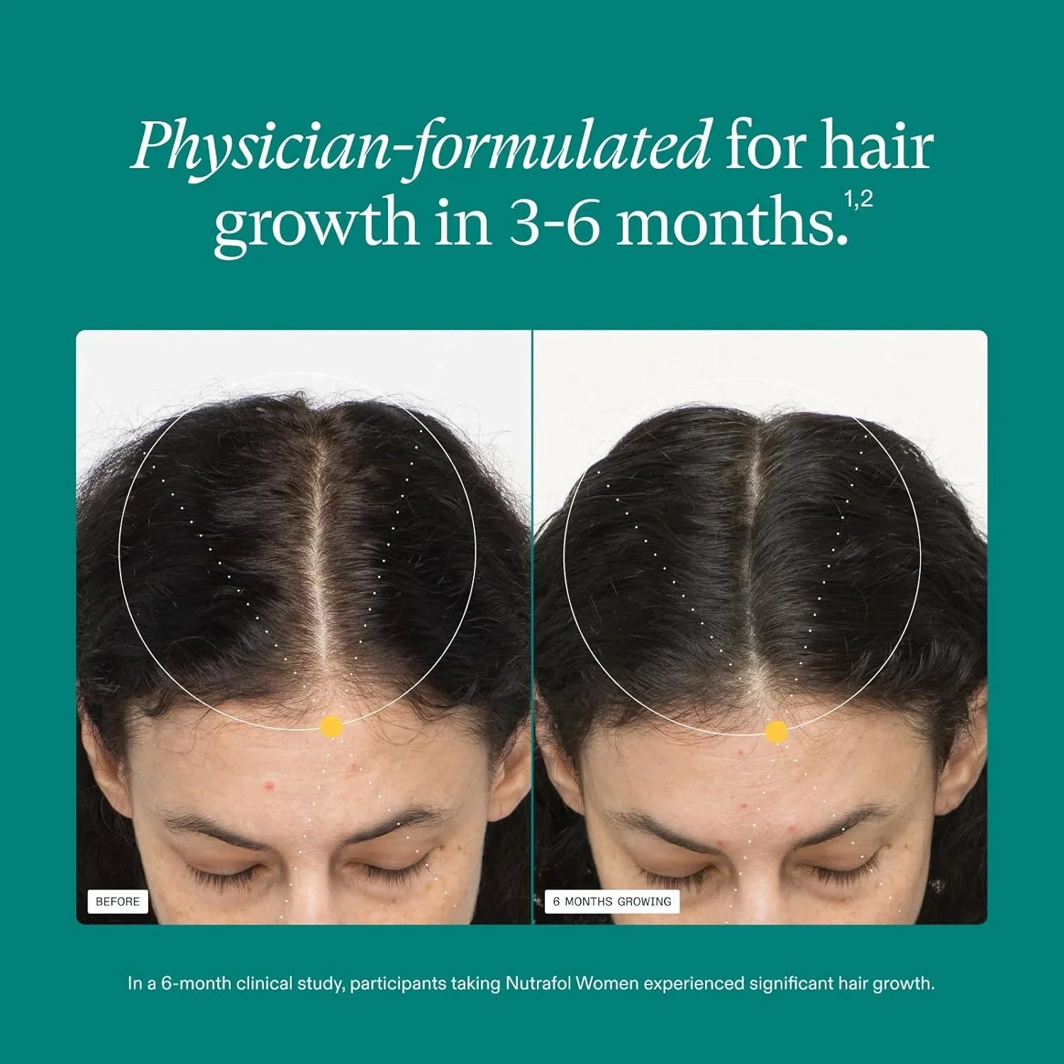 WOMEN Hair Growth Supplements, 3 MONTH SUPPLY, For Women 18-44 Years Old, Dermatologist Recommended - MariposaSkincare.com