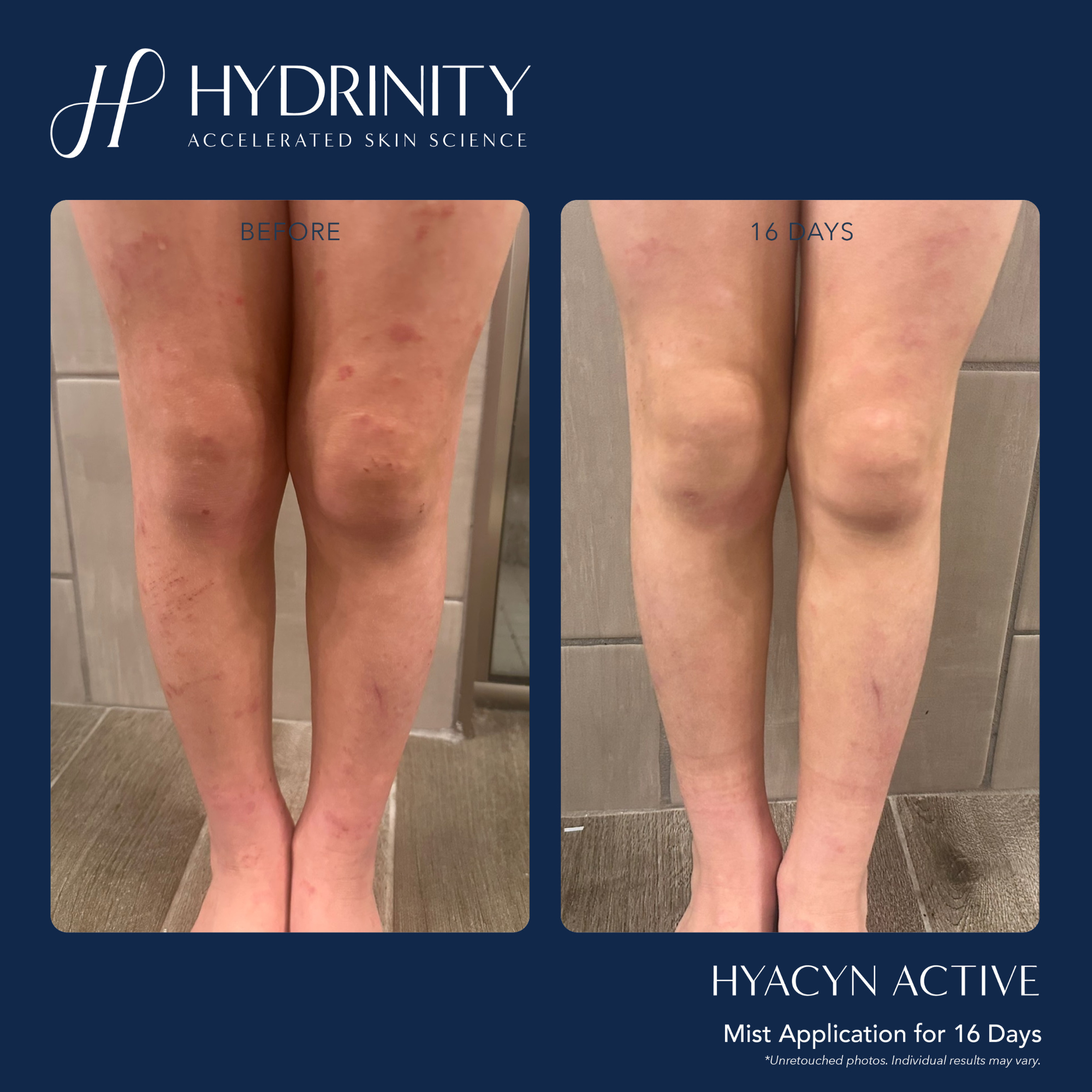 HYACYN ACTIVE - MariposaSkincare.com