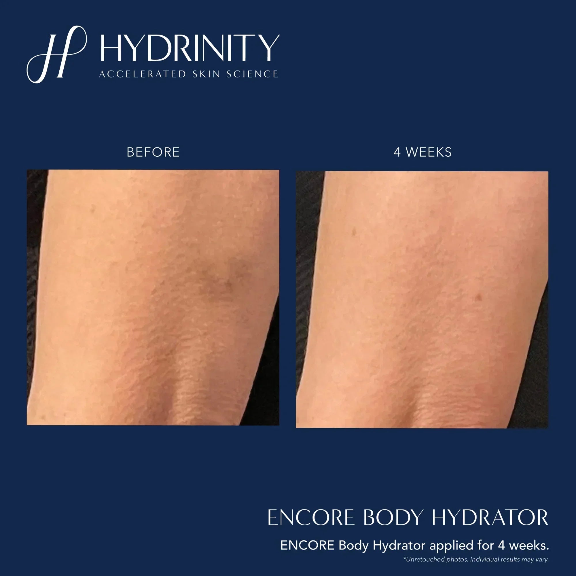 Hydrinity Hydrating Body Lotion - ENCORE
