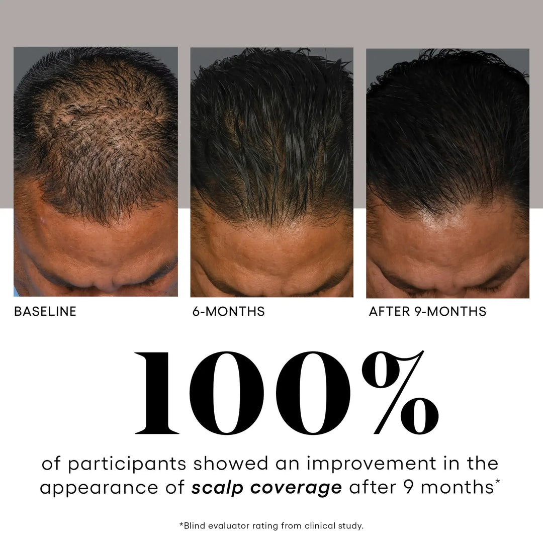 ( plated )™ Hair Growth Serum for Fuller, Thicker Hair