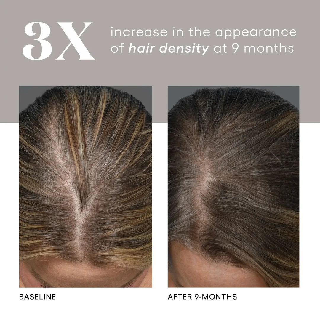 ( plated )™ Hair Growth Serum for Fuller, Thicker Hair