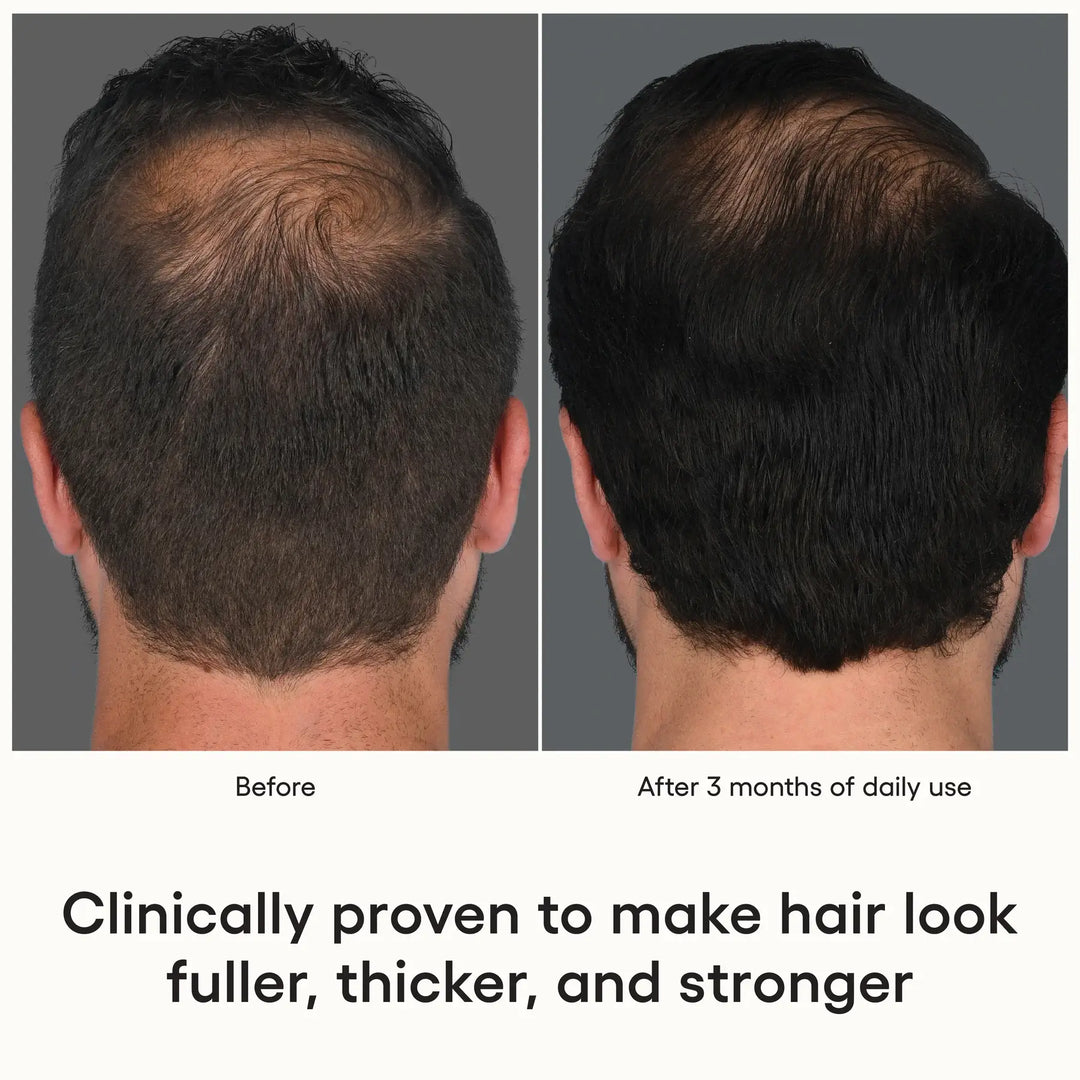 ( plated )™ Hair Growth Serum for Fuller, Thicker Hair